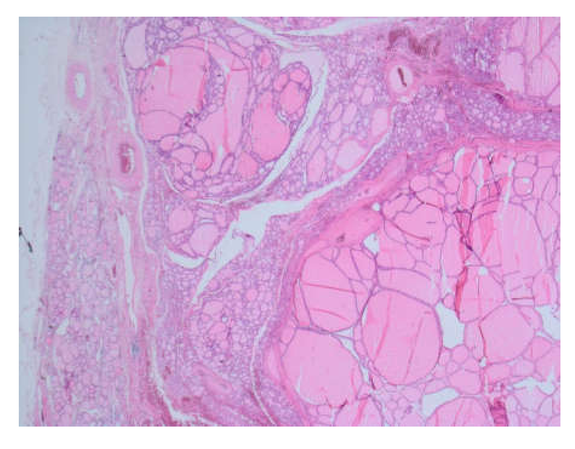 Medicina 56 00290 g005