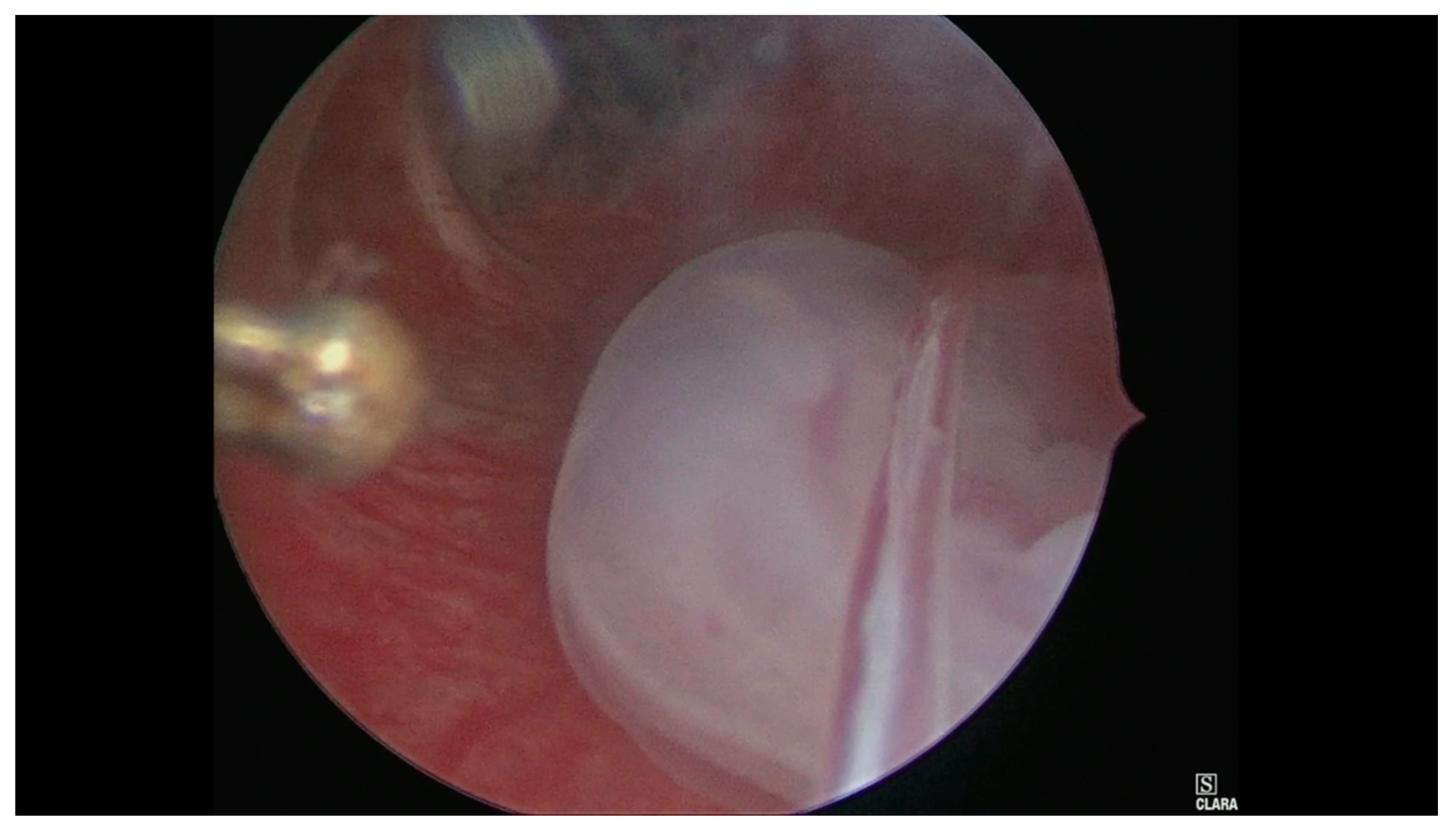 Medicina 56 00293 g003