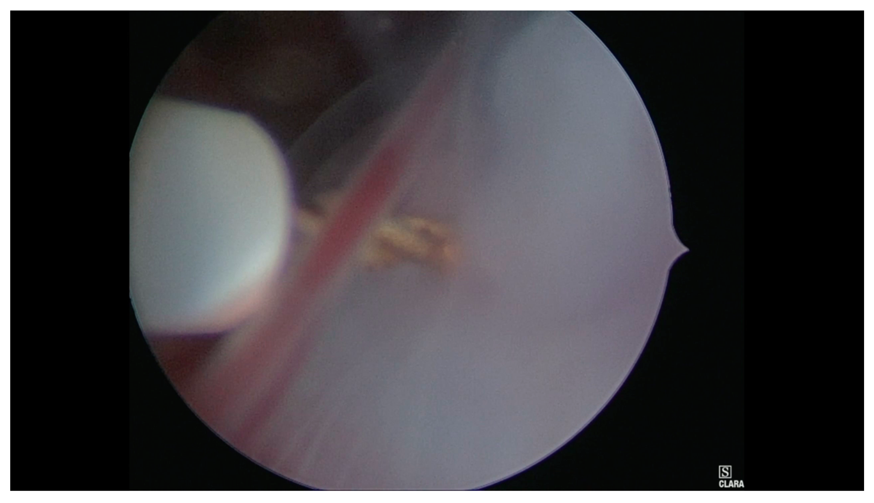 Medicina 56 00293 g004