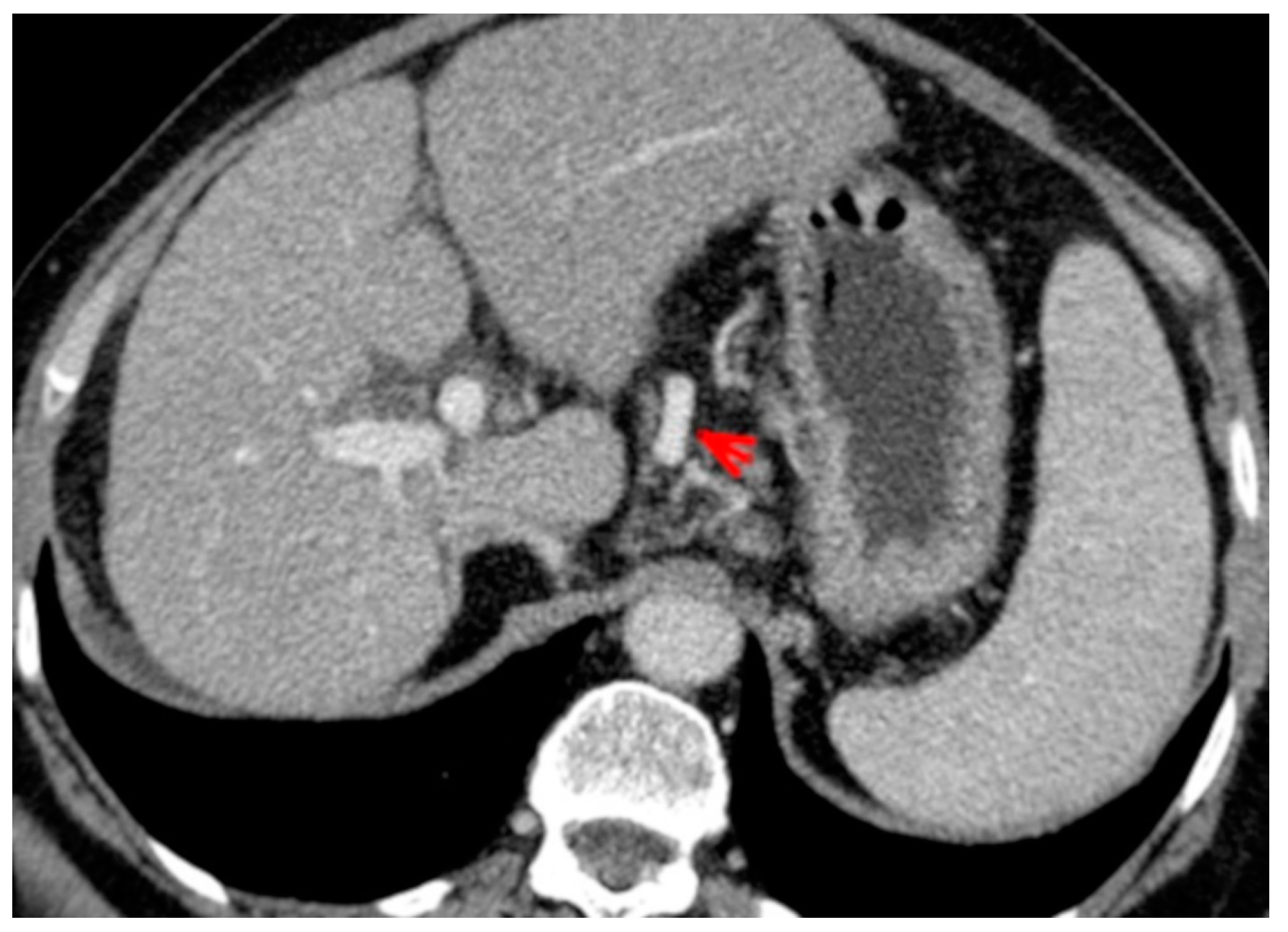 Medicina 56 00301 g003