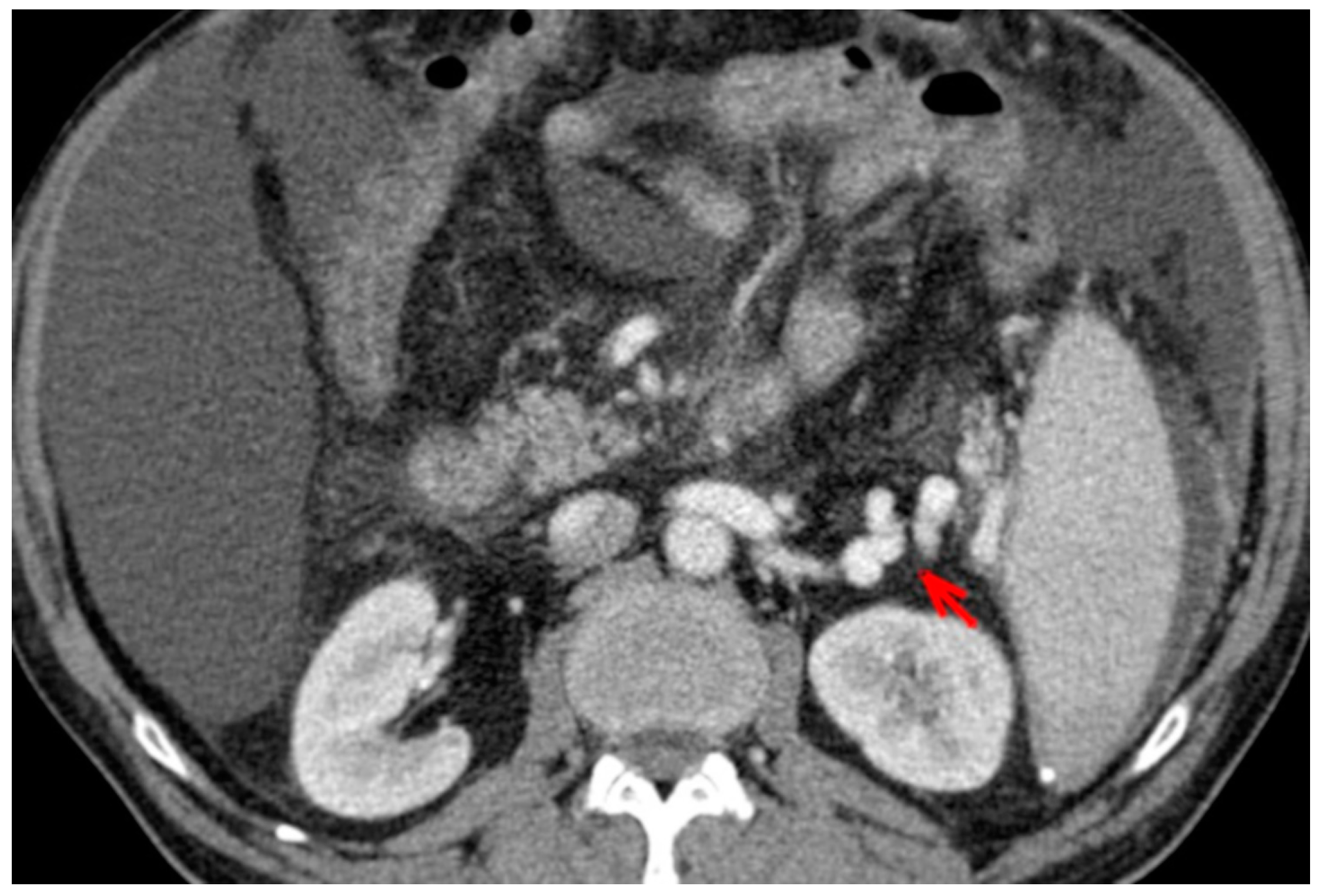Medicina 56 00301 g004