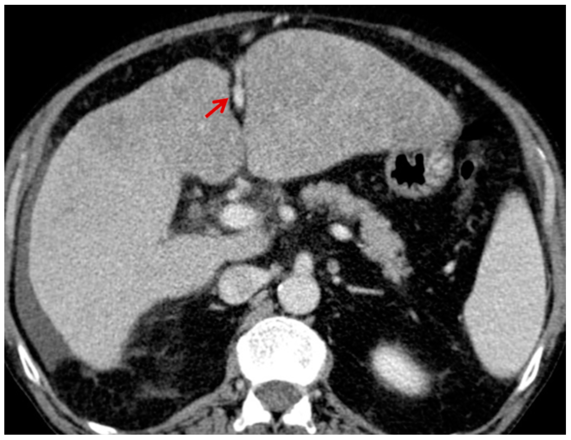 Medicina 56 00301 g005