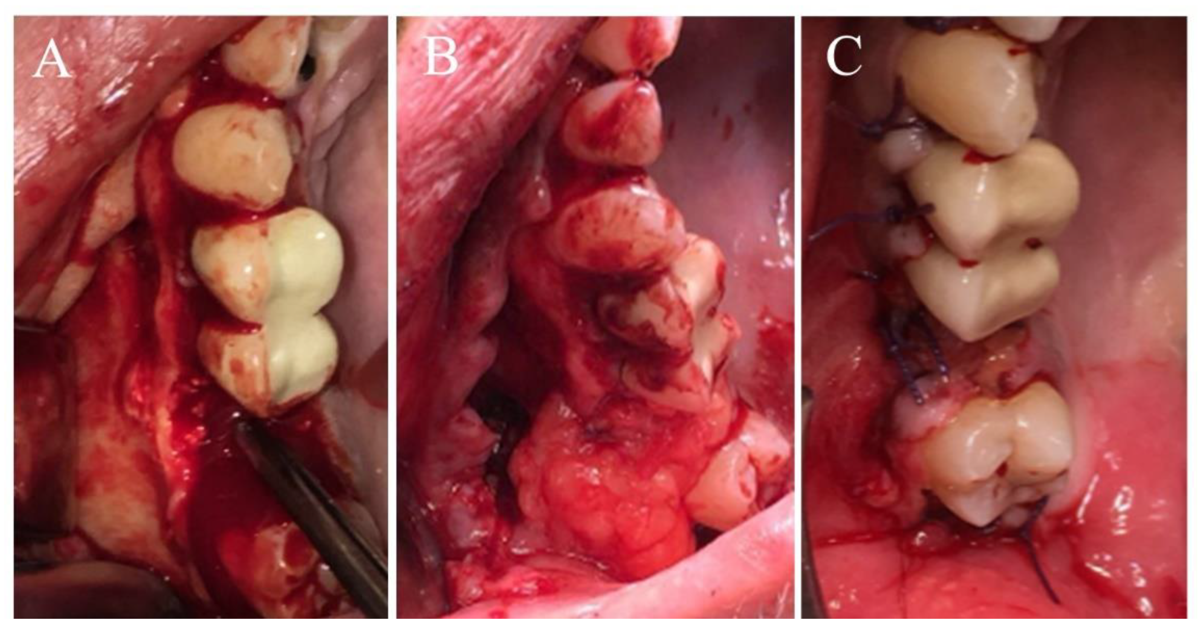 Medicina 56 00310 g002 Medicina 56 00310 g002