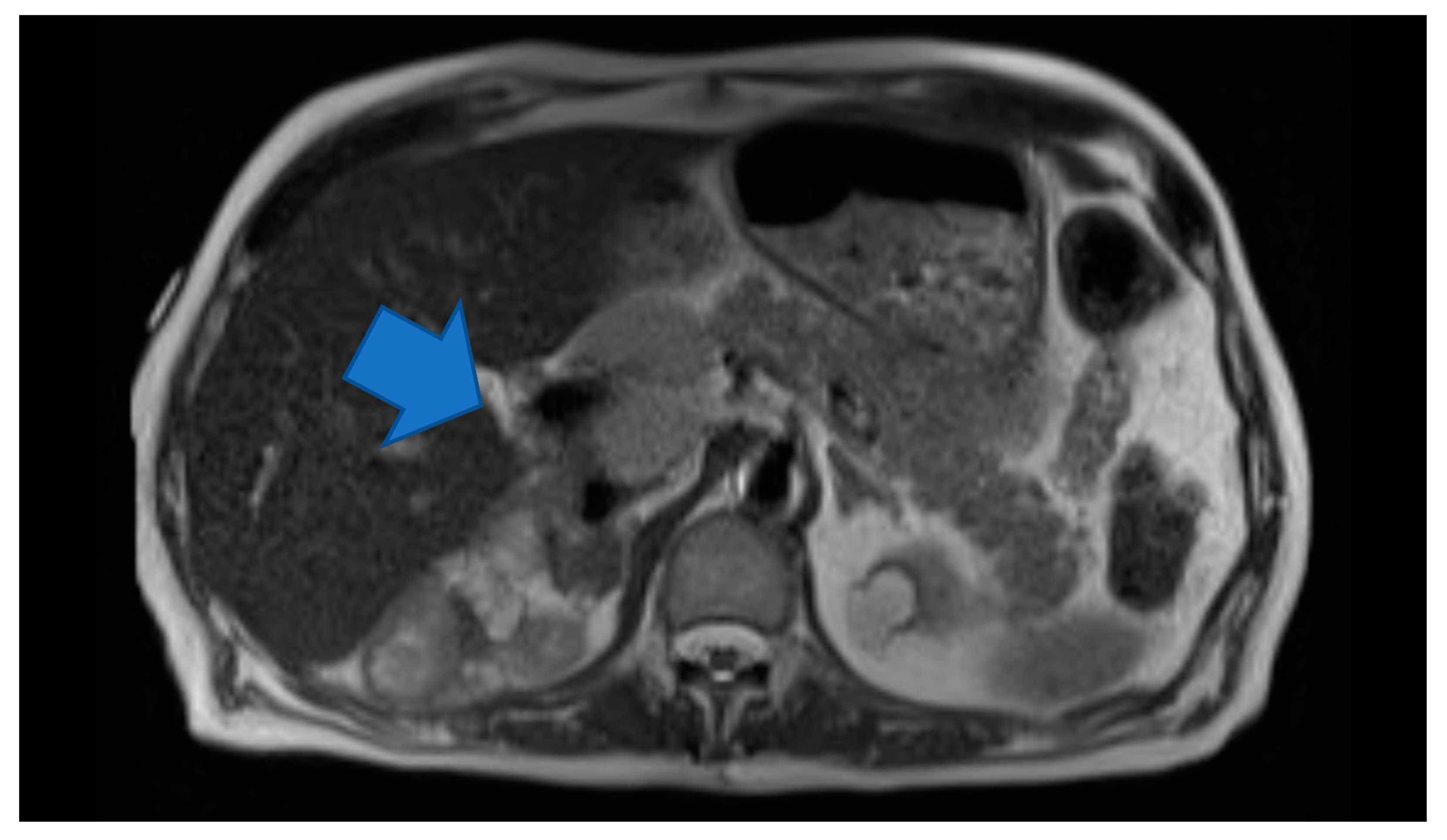 Medicina 56 00316 g001