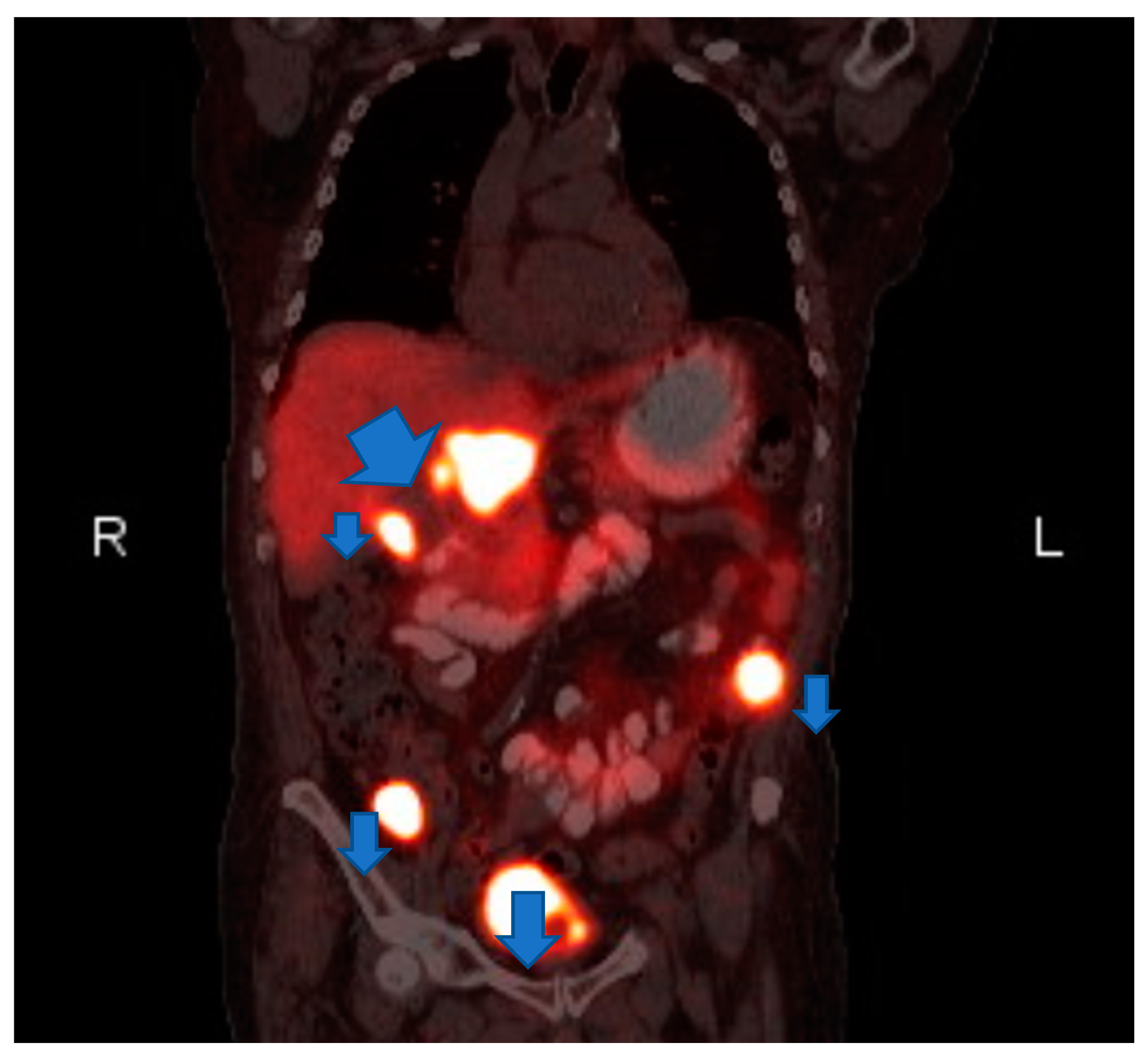 Medicina 56 00316 g002