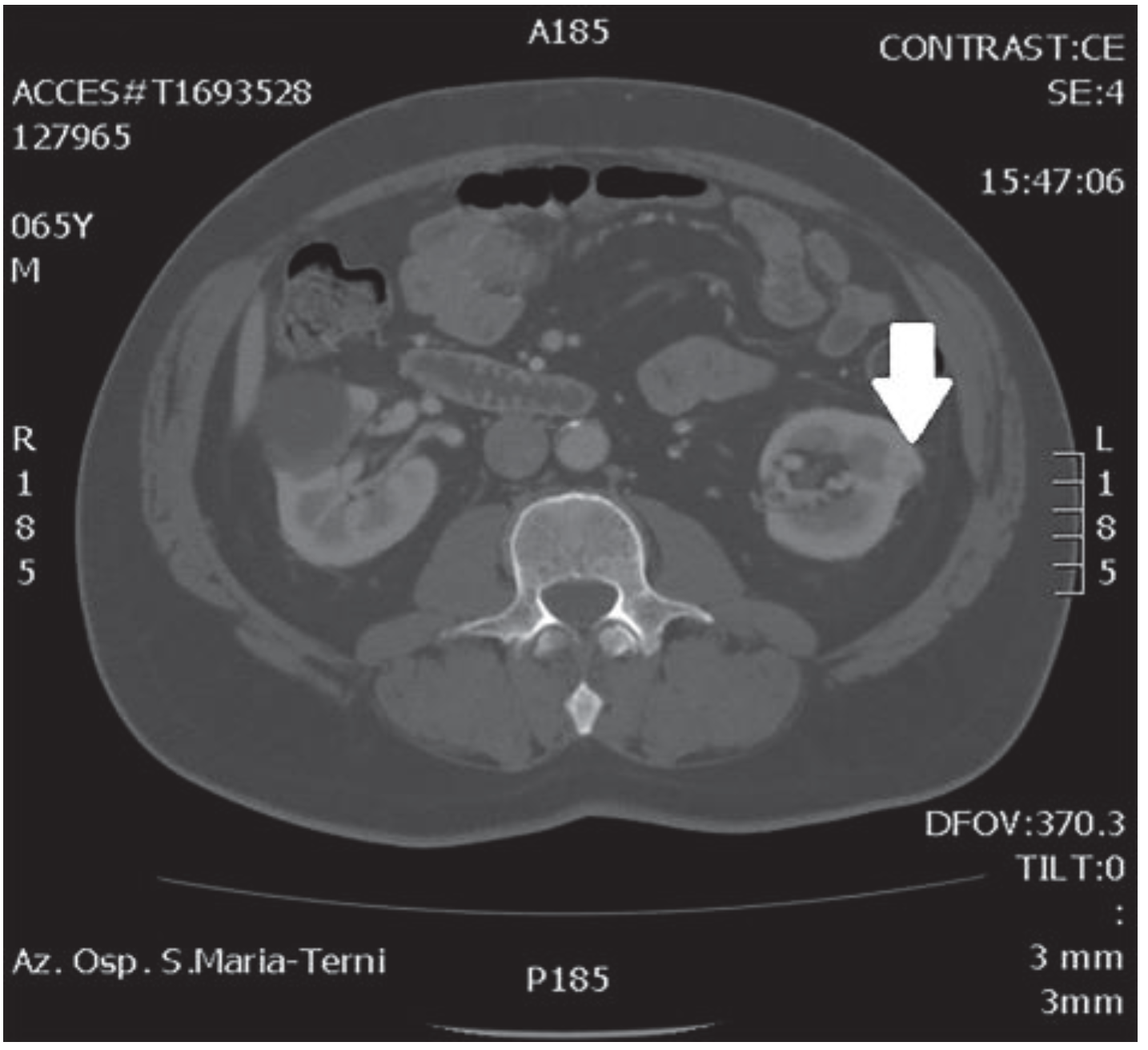 Medicina 56 00318 g001 Medicina 56 00318 g001