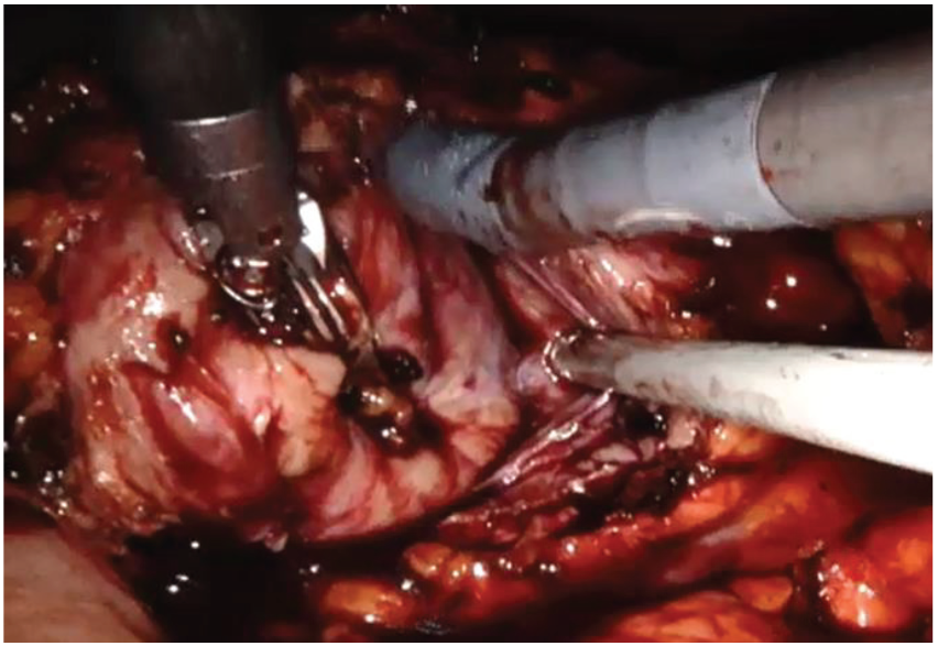 Medicina 56 00318 g004 Medicina 56 00318 g004