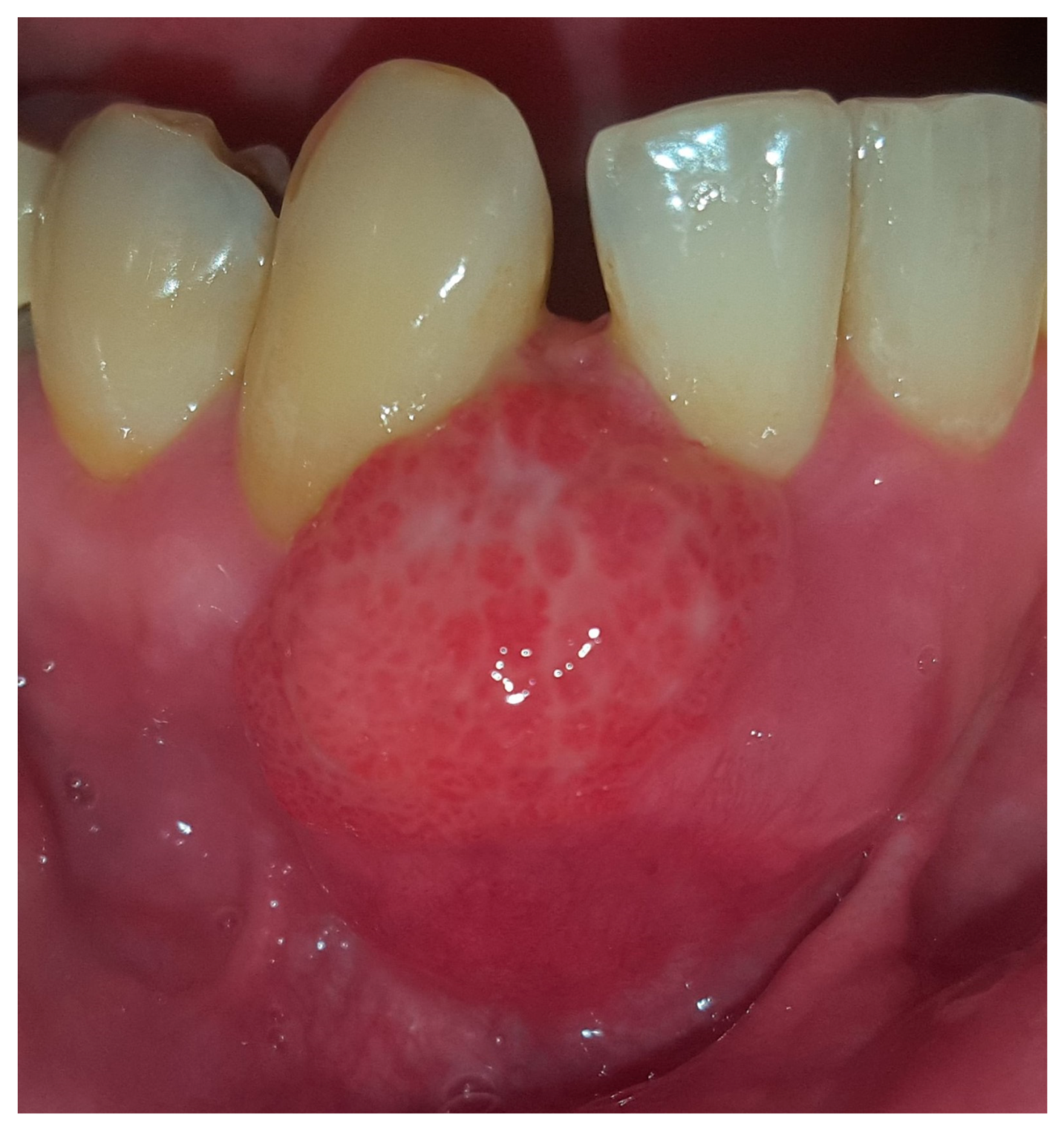 Medicina 56 00326 g001