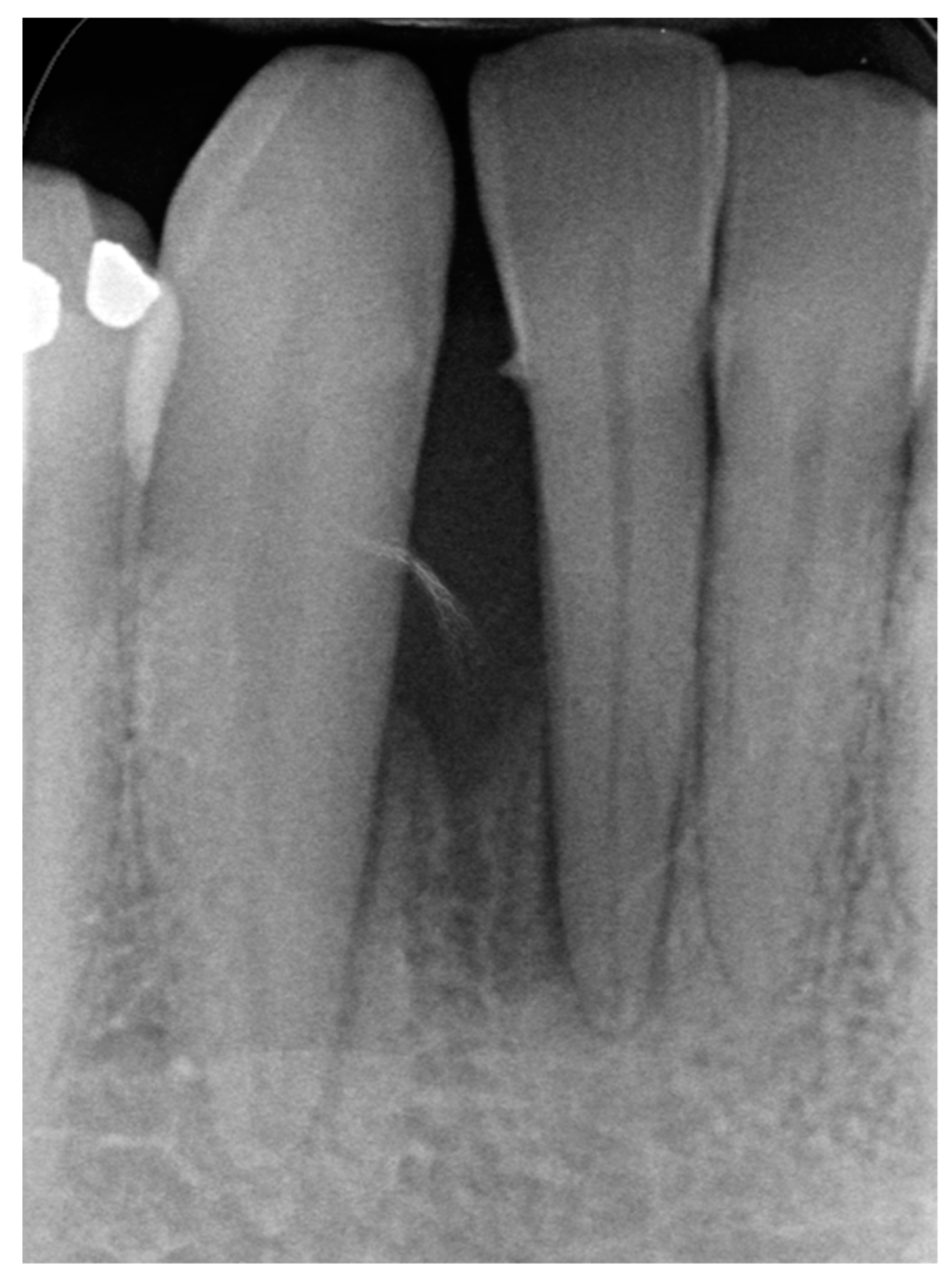 Medicina 56 00326 g002