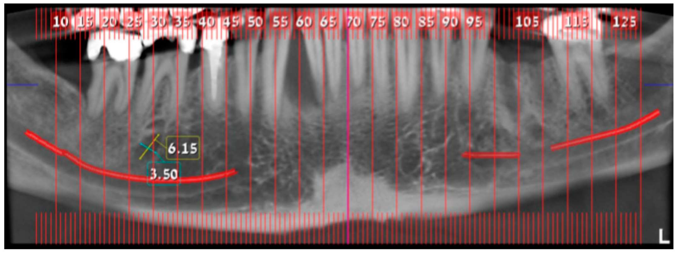 Medicina 56 00326 g003