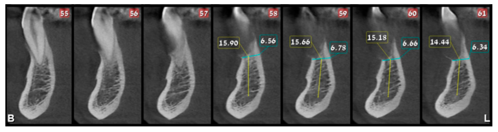 Medicina 56 00326 g004a