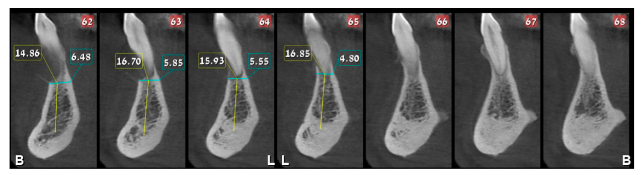 Medicina 56 00326 g004b