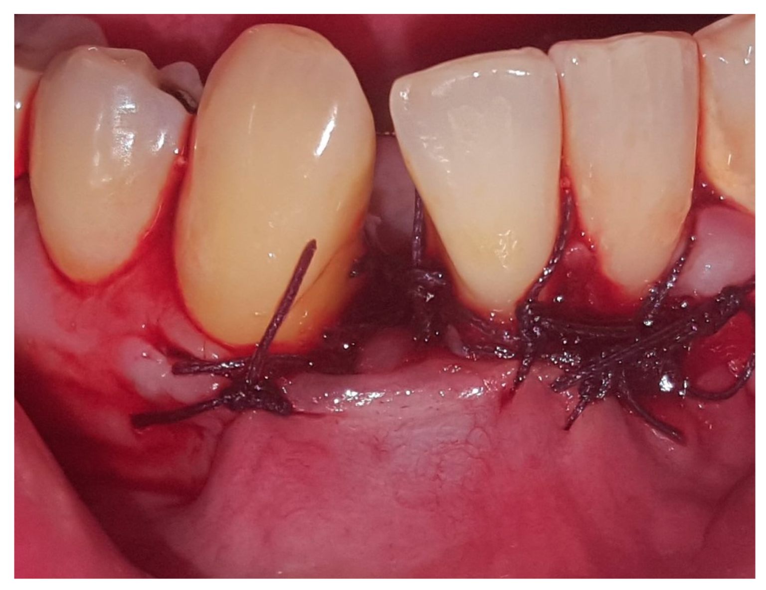 Medicina 56 00326 g005