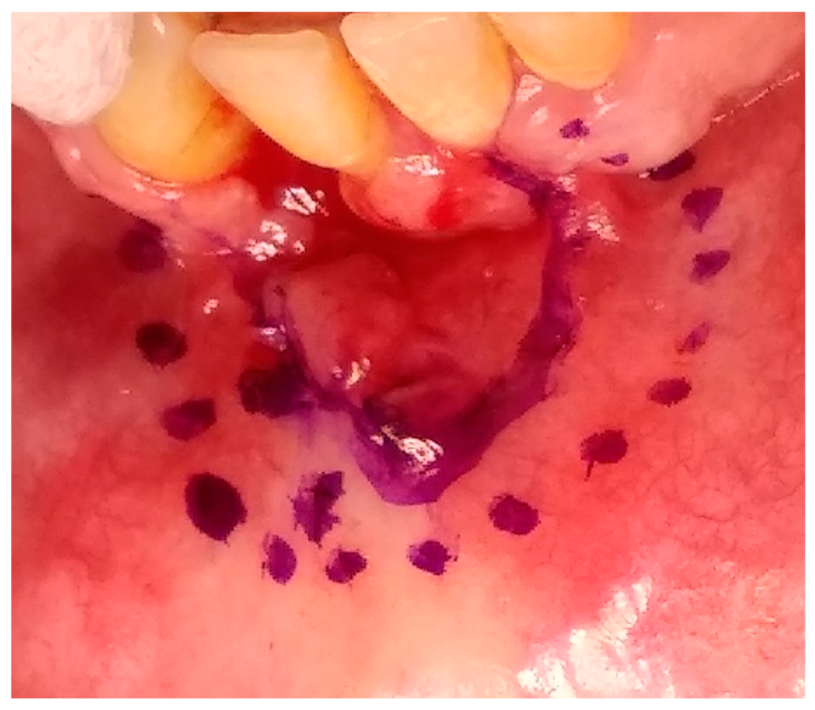 Medicina 56 00326 g008