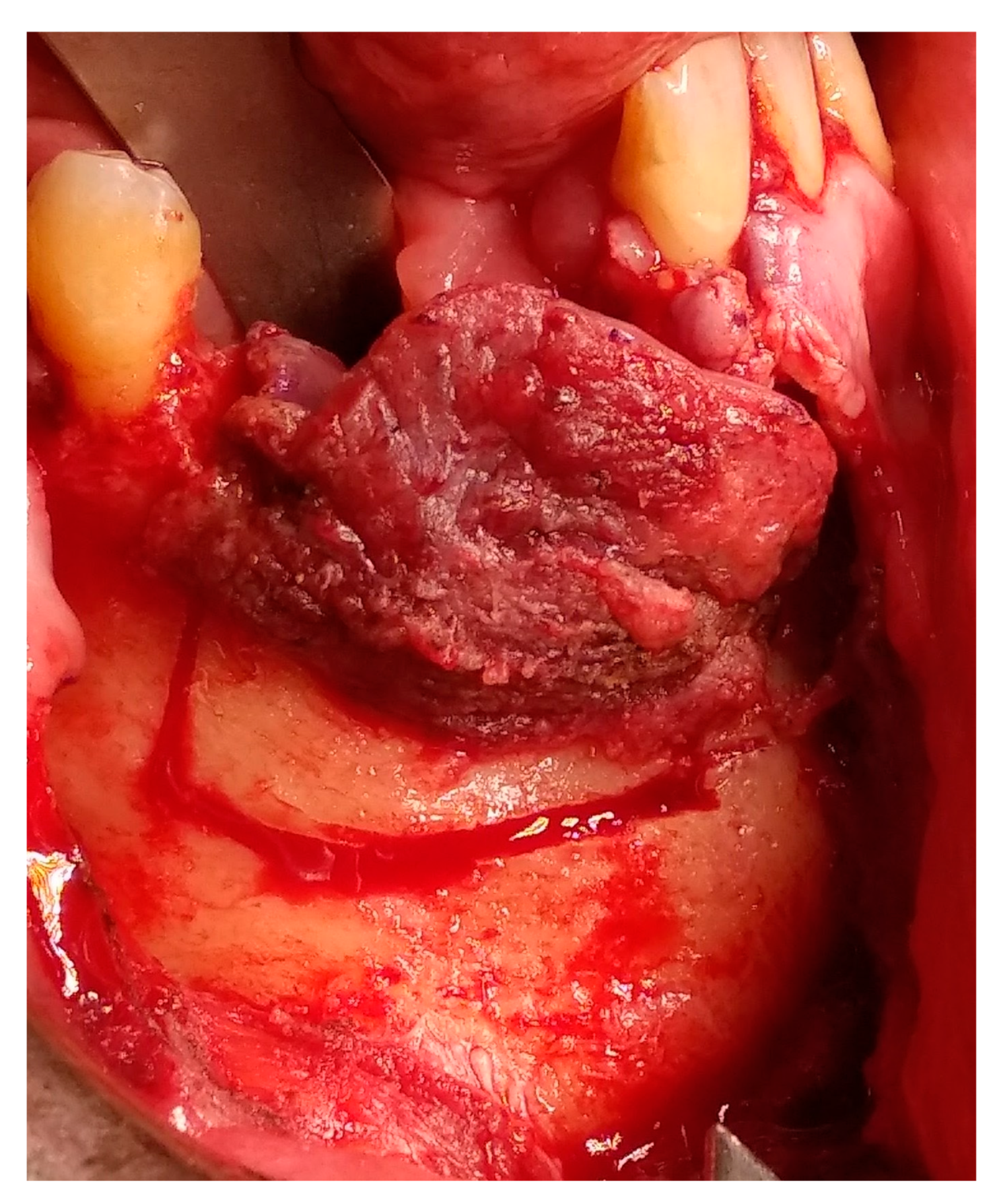 Medicina 56 00326 g009