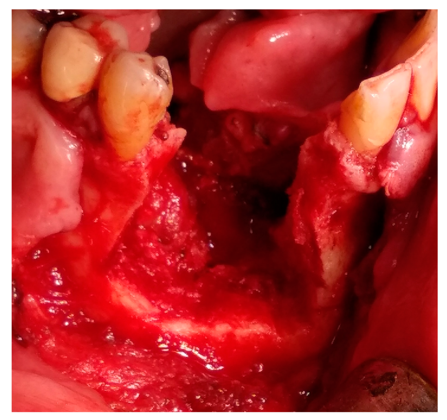 Medicina 56 00326 g010