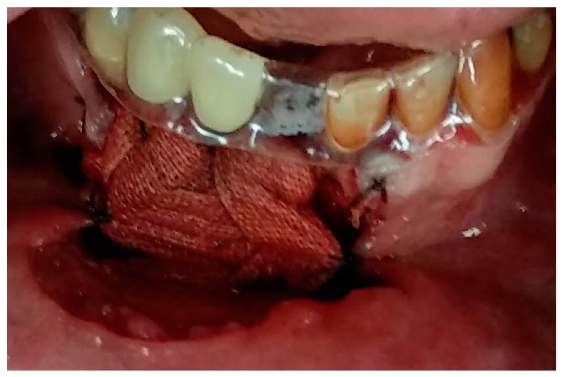 Medicina 56 00326 g011