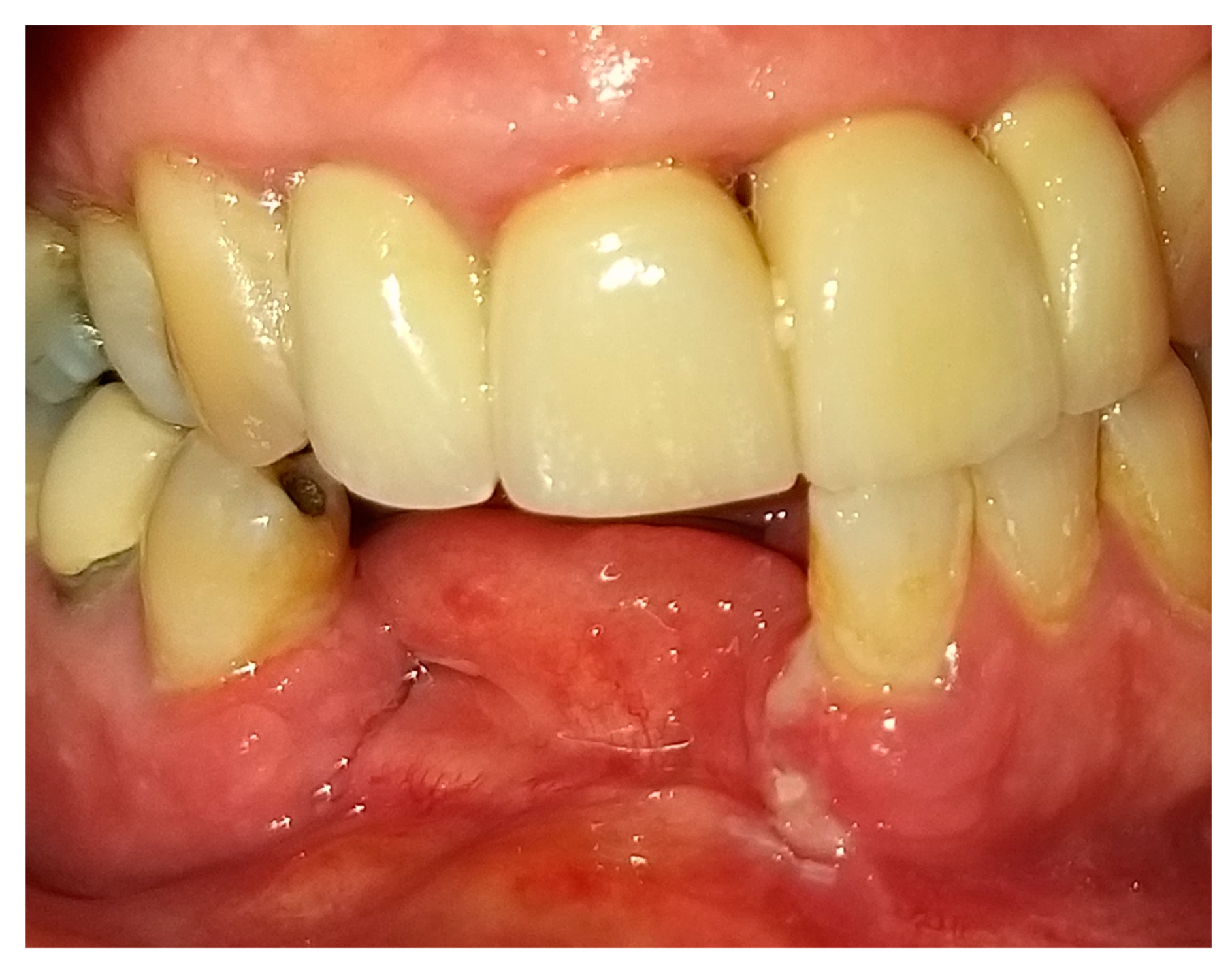 Medicina 56 00326 g012