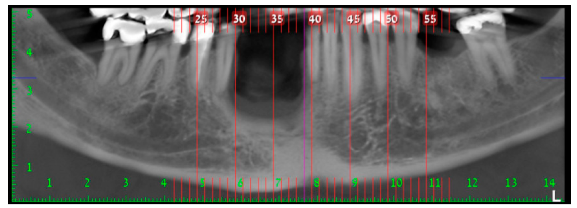 Medicina 56 00326 g013
