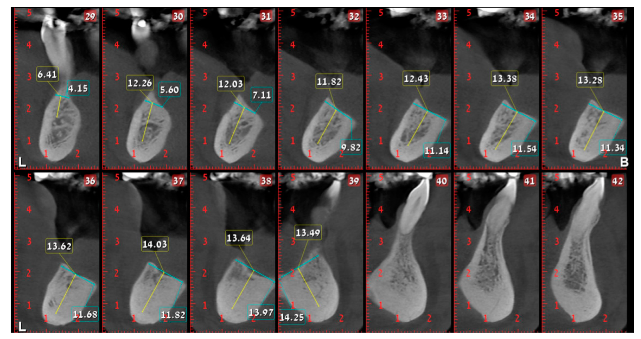 Medicina 56 00326 g014