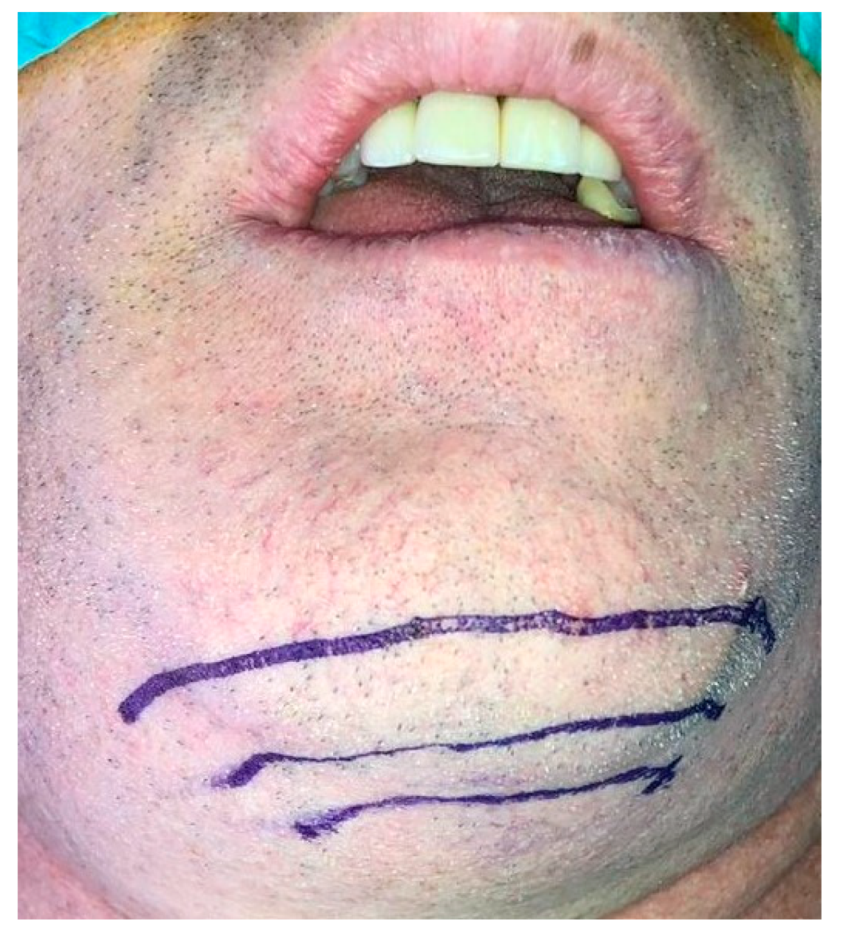 Medicina 56 00326 g015