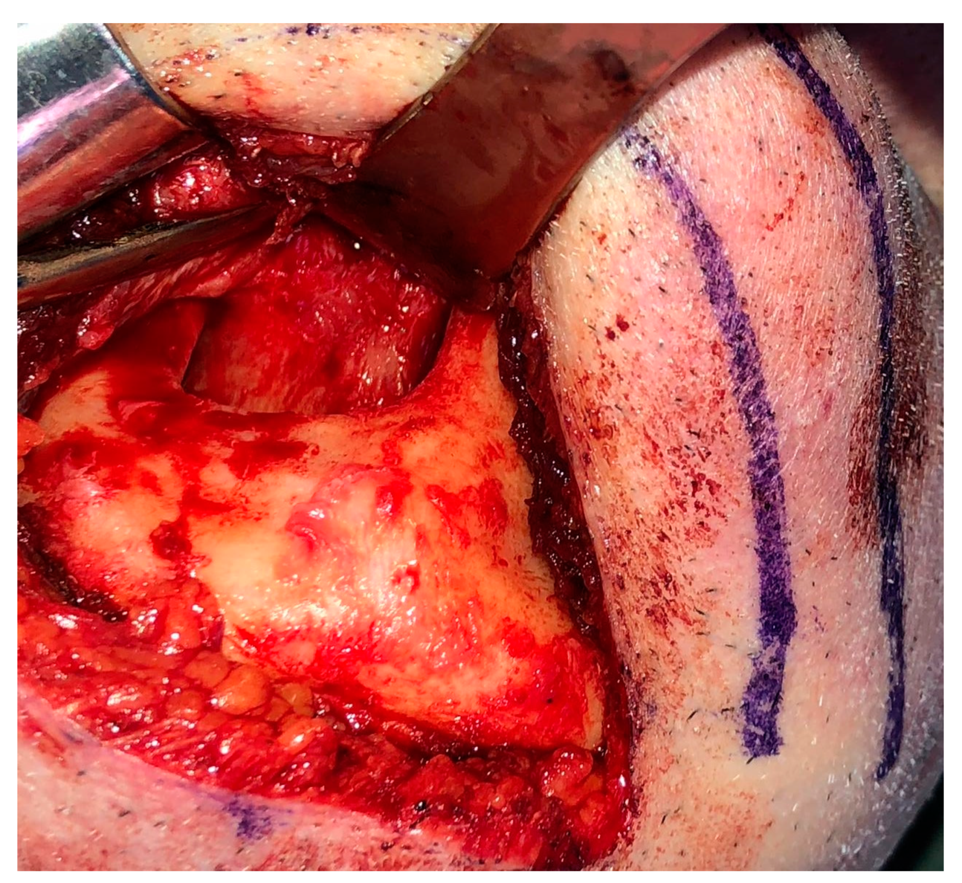 Medicina 56 00326 g016