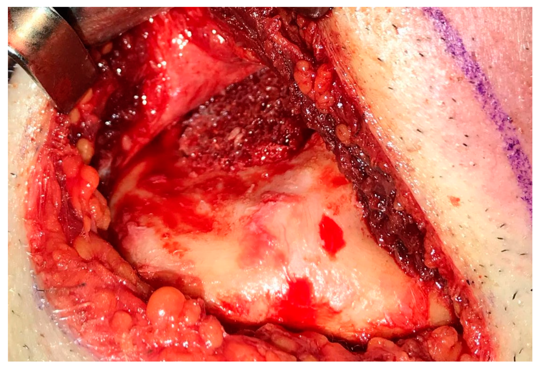 Medicina 56 00326 g017