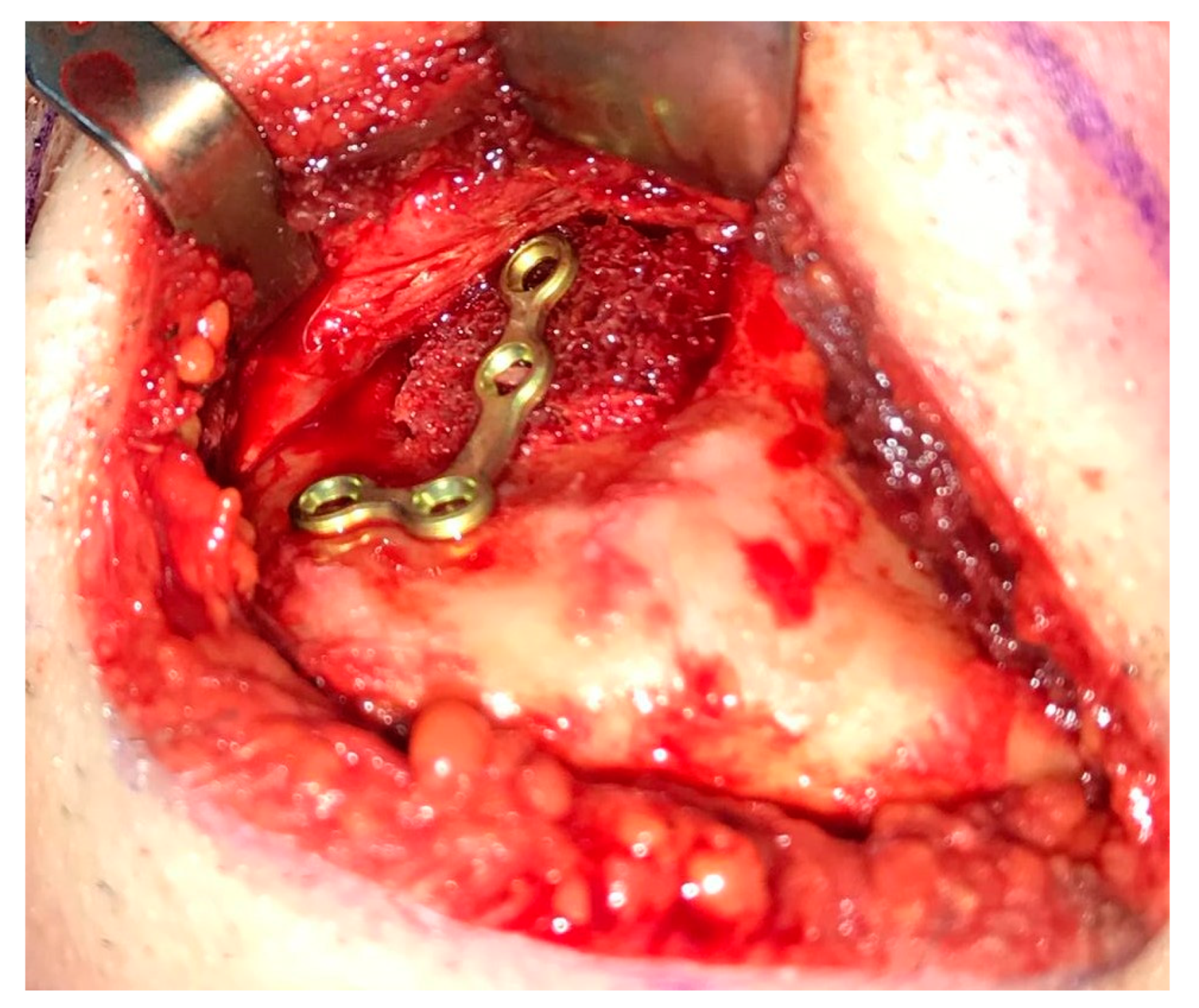 Medicina 56 00326 g018