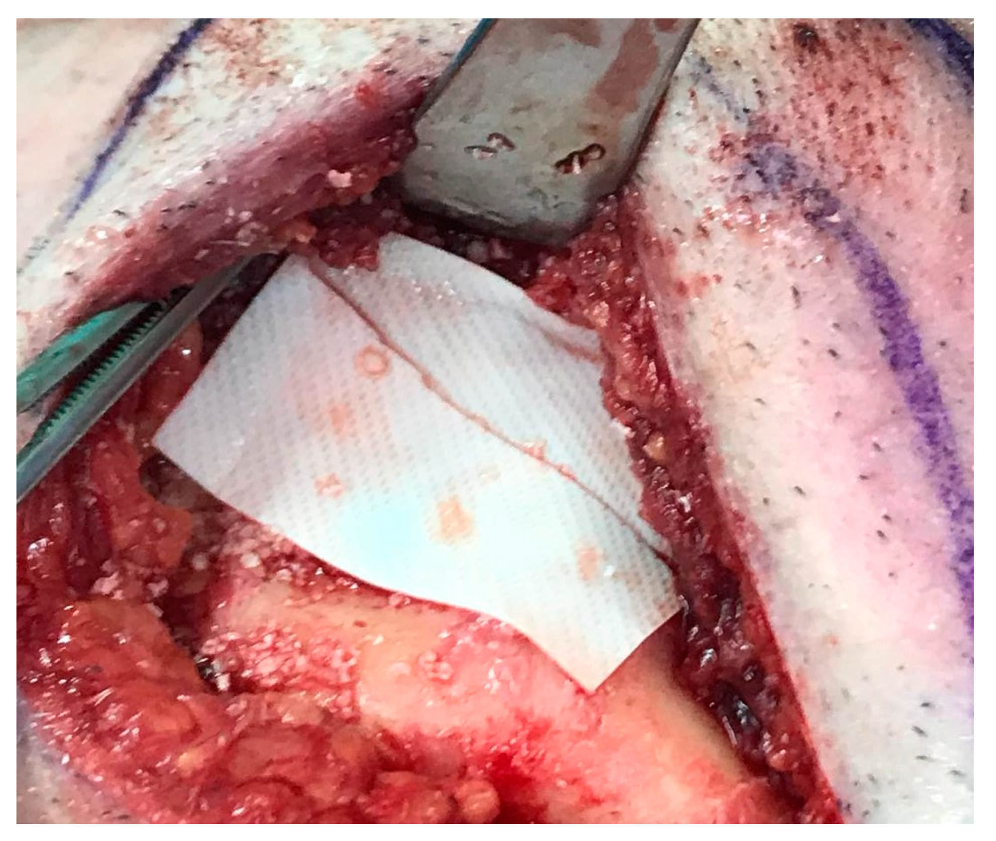 Medicina 56 00326 g020