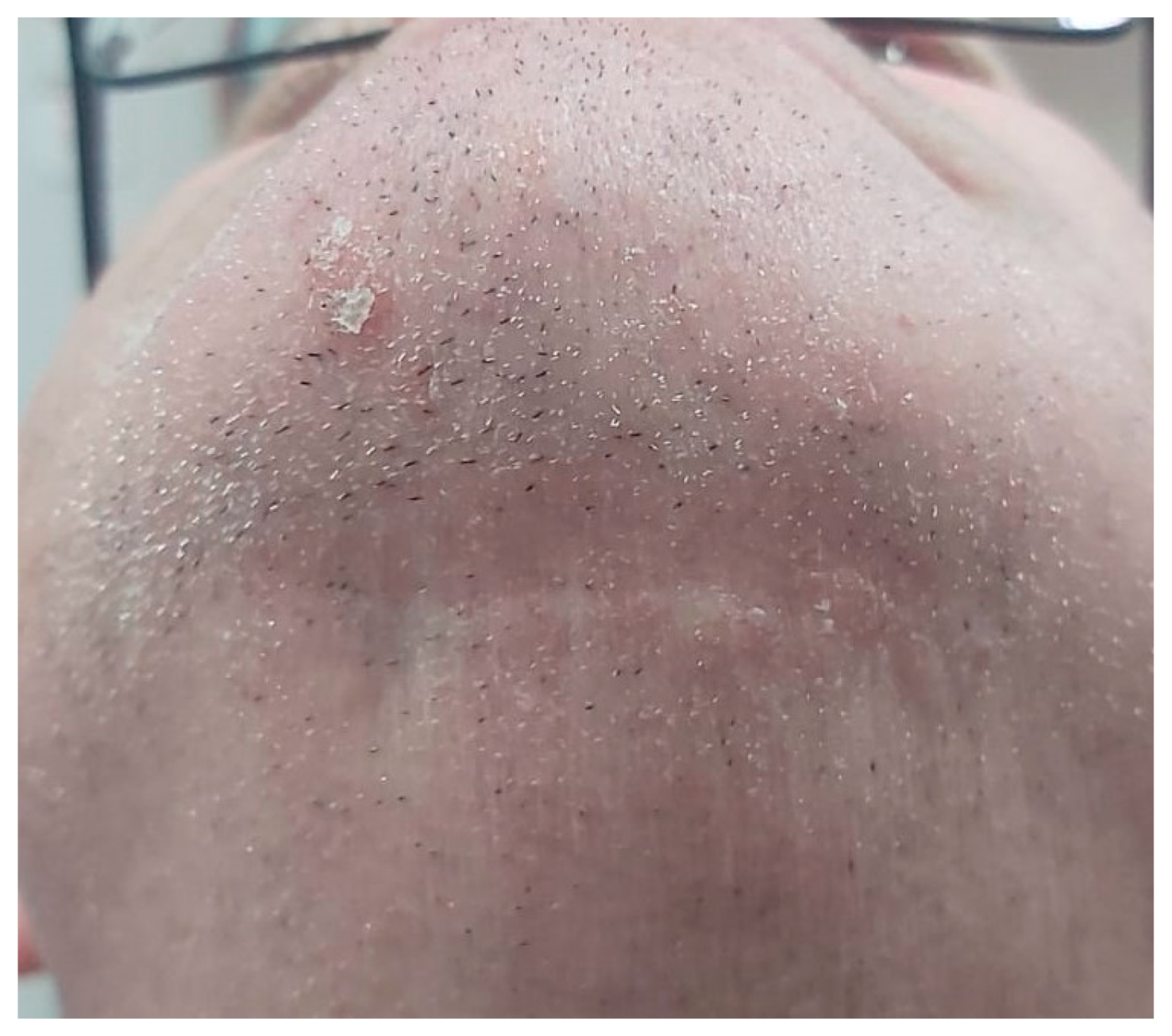 Medicina 56 00326 g023