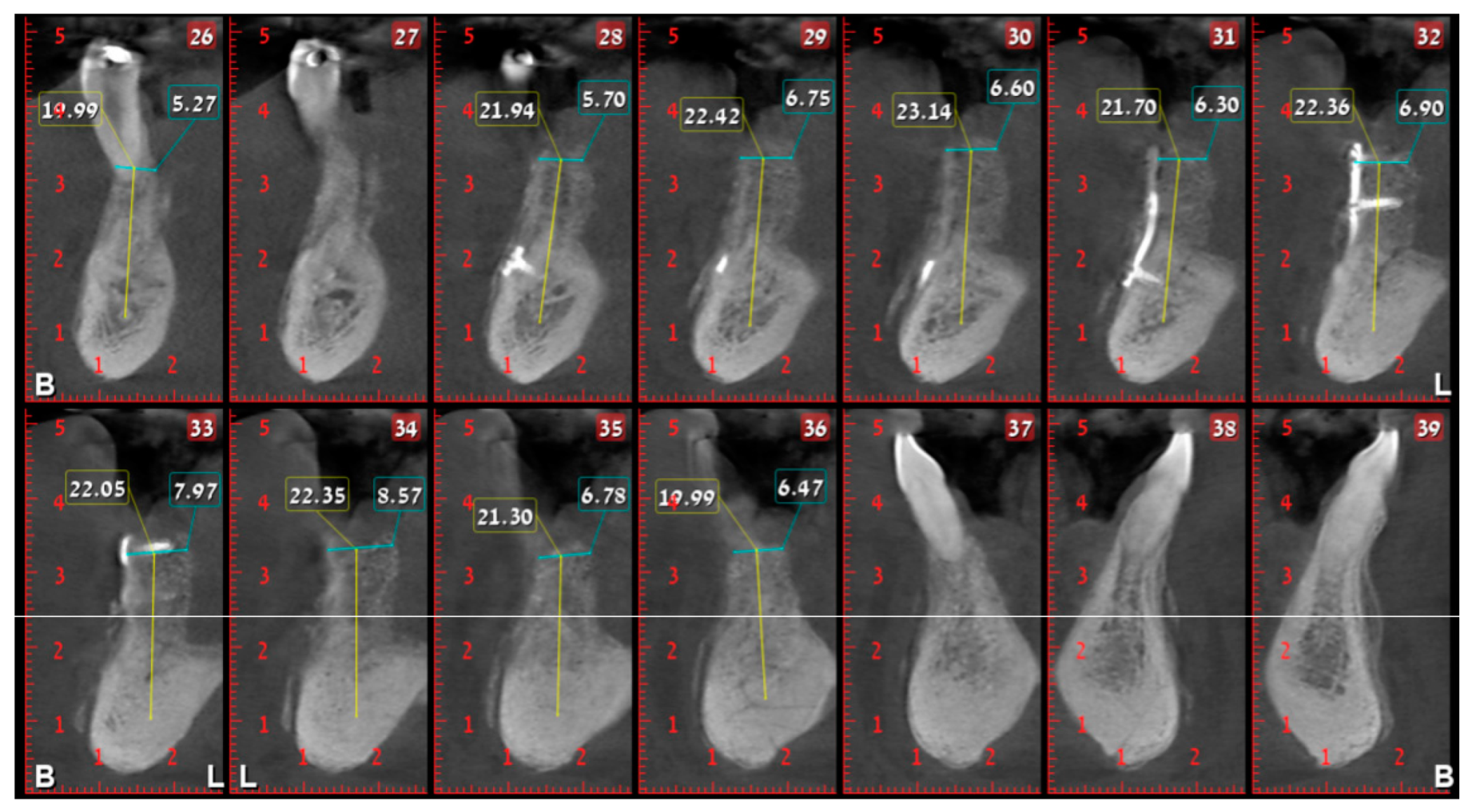Medicina 56 00326 g025