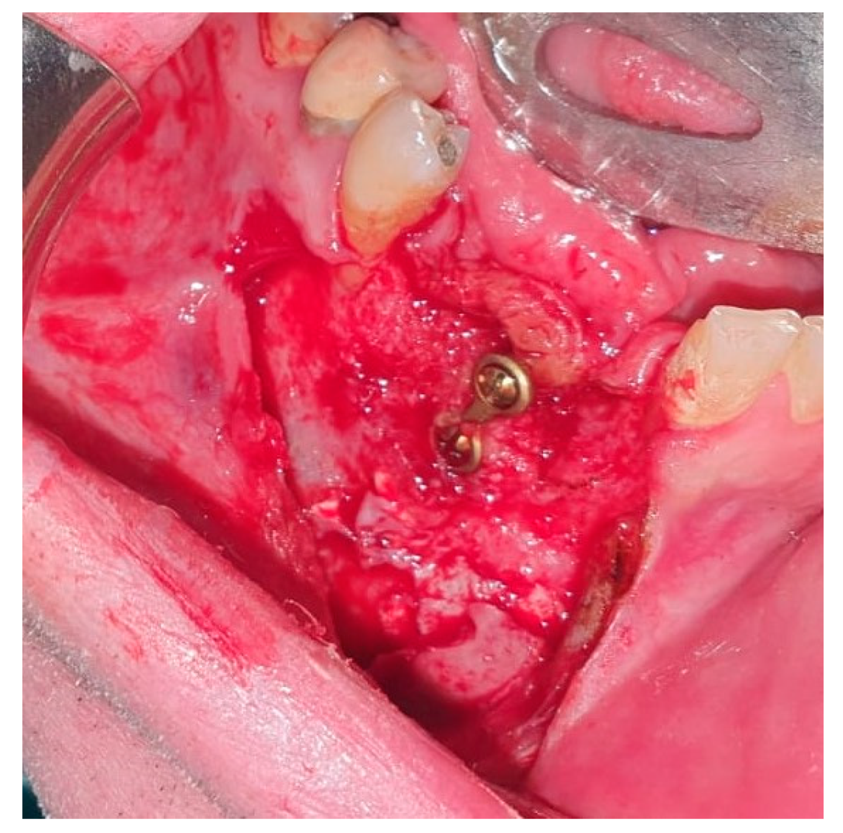 Medicina 56 00326 g026