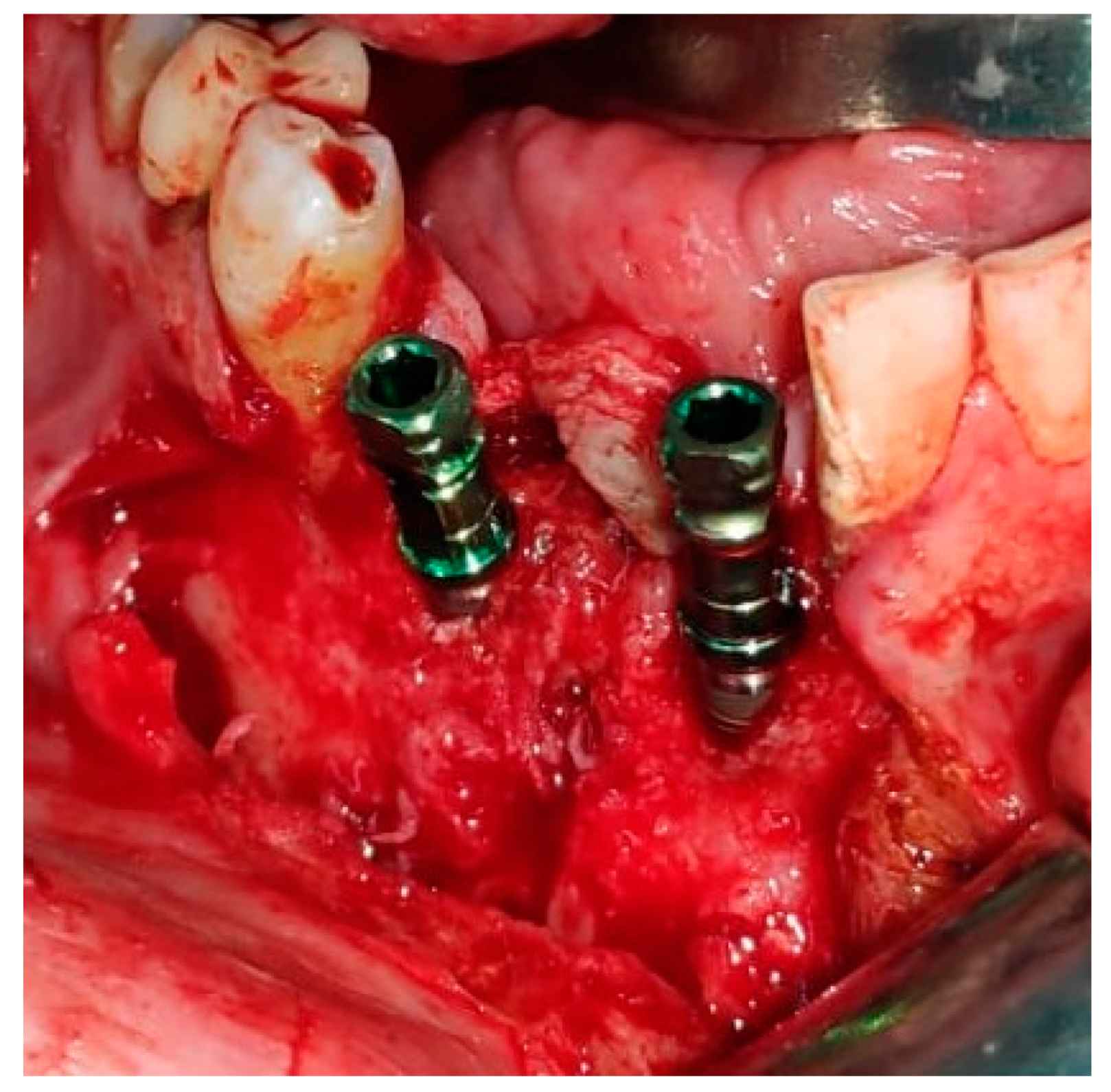 Medicina 56 00326 g027