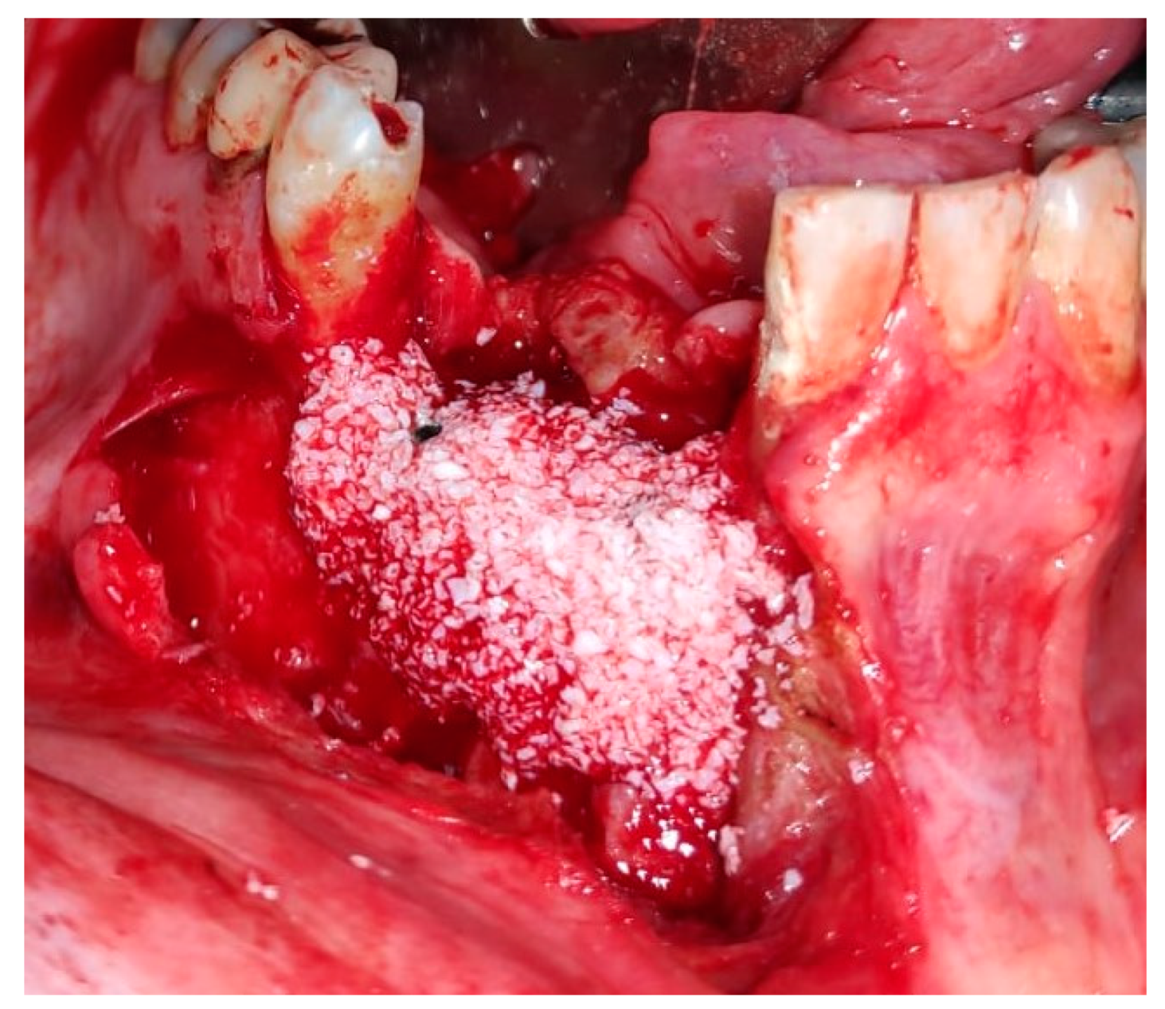 Medicina 56 00326 g028