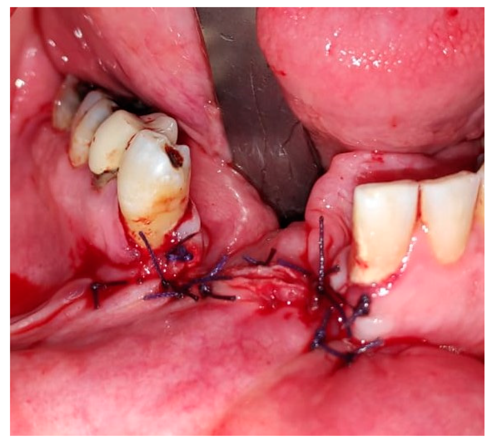 Medicina 56 00326 g029