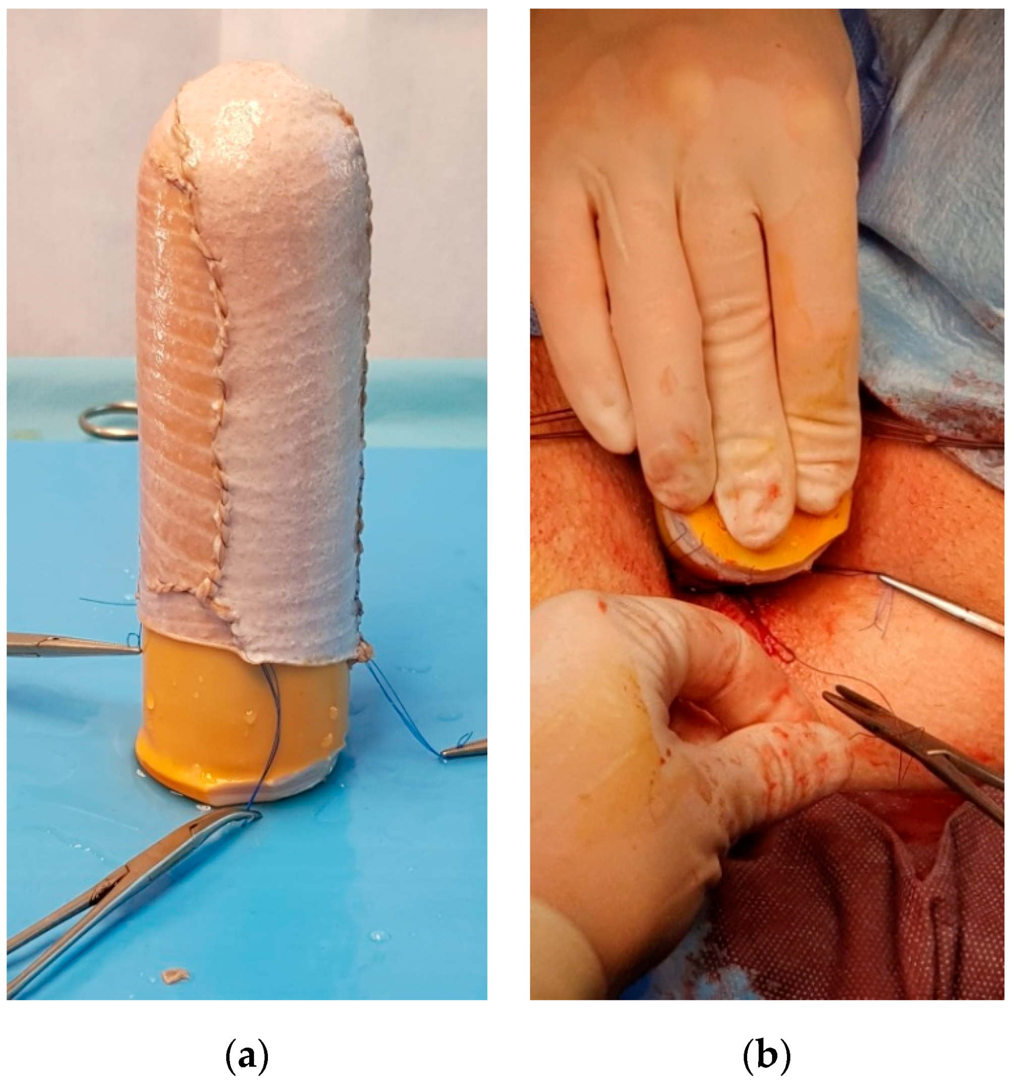 Medicina 56 00327 g003