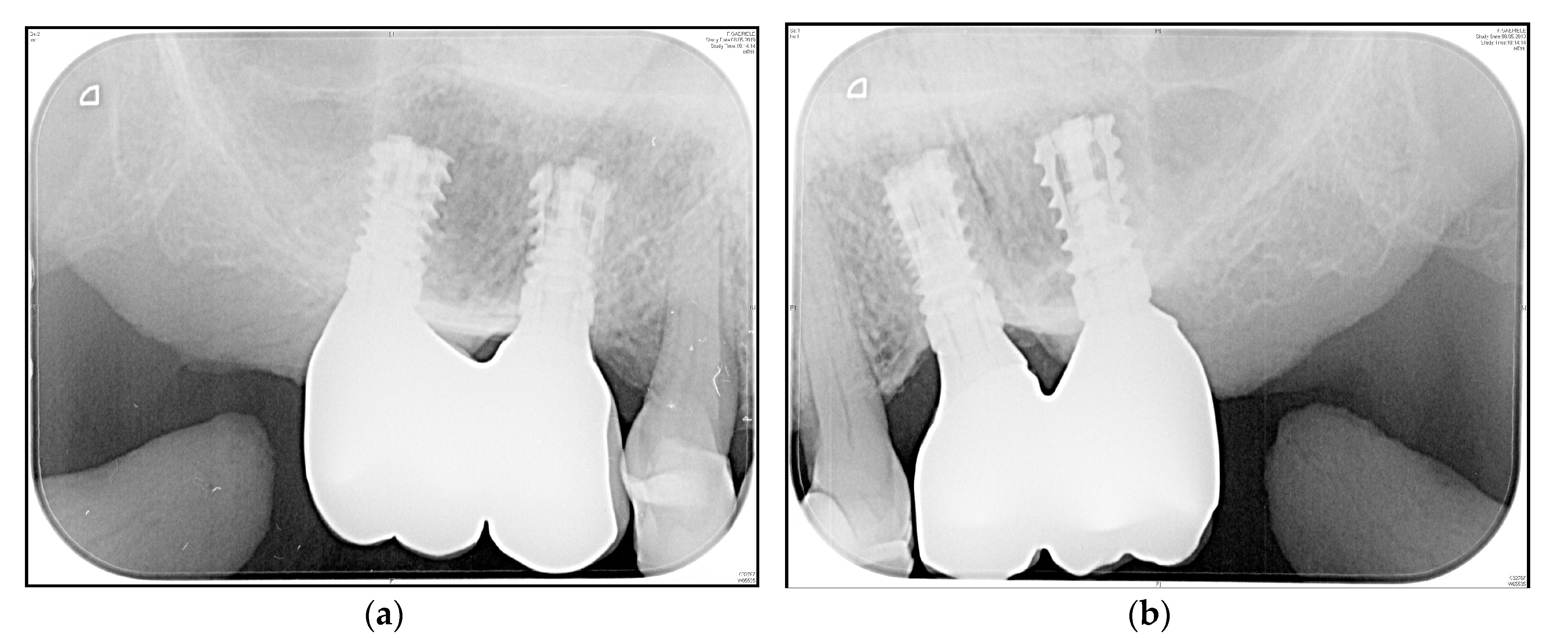 Medicina 56 00333 g007