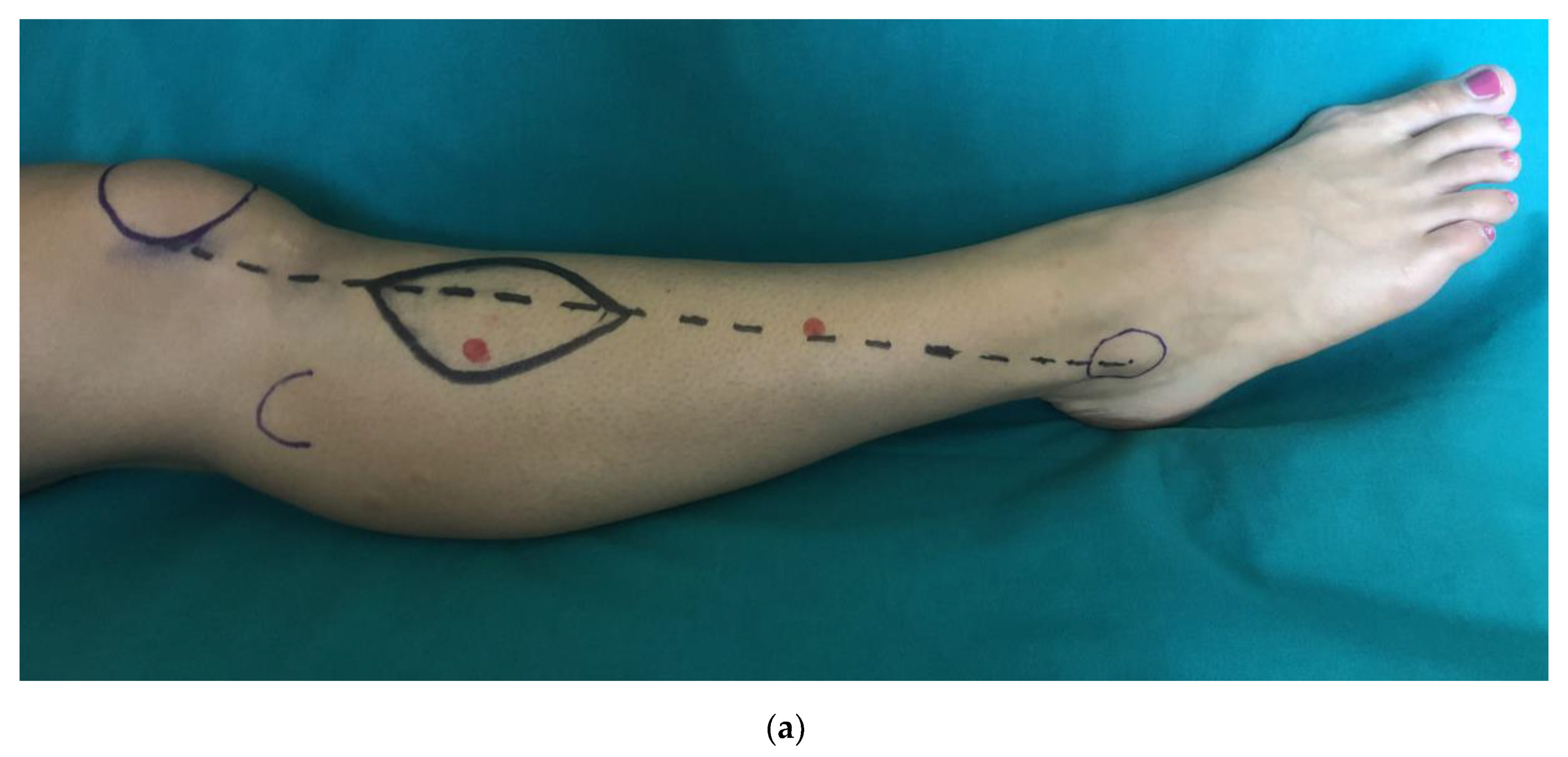 Medicina 56 00338 g001a