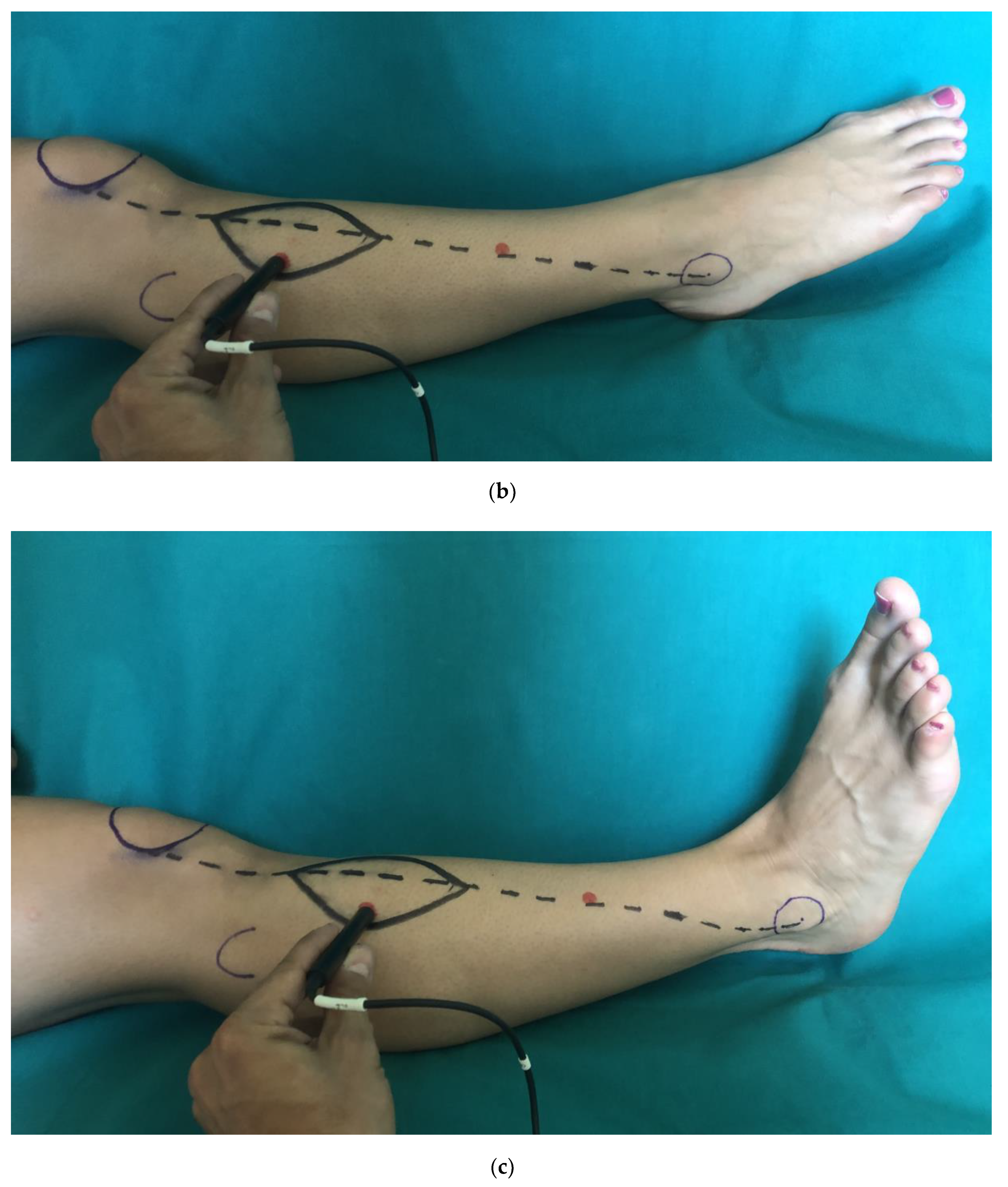 Medicina 56 00338 g001b