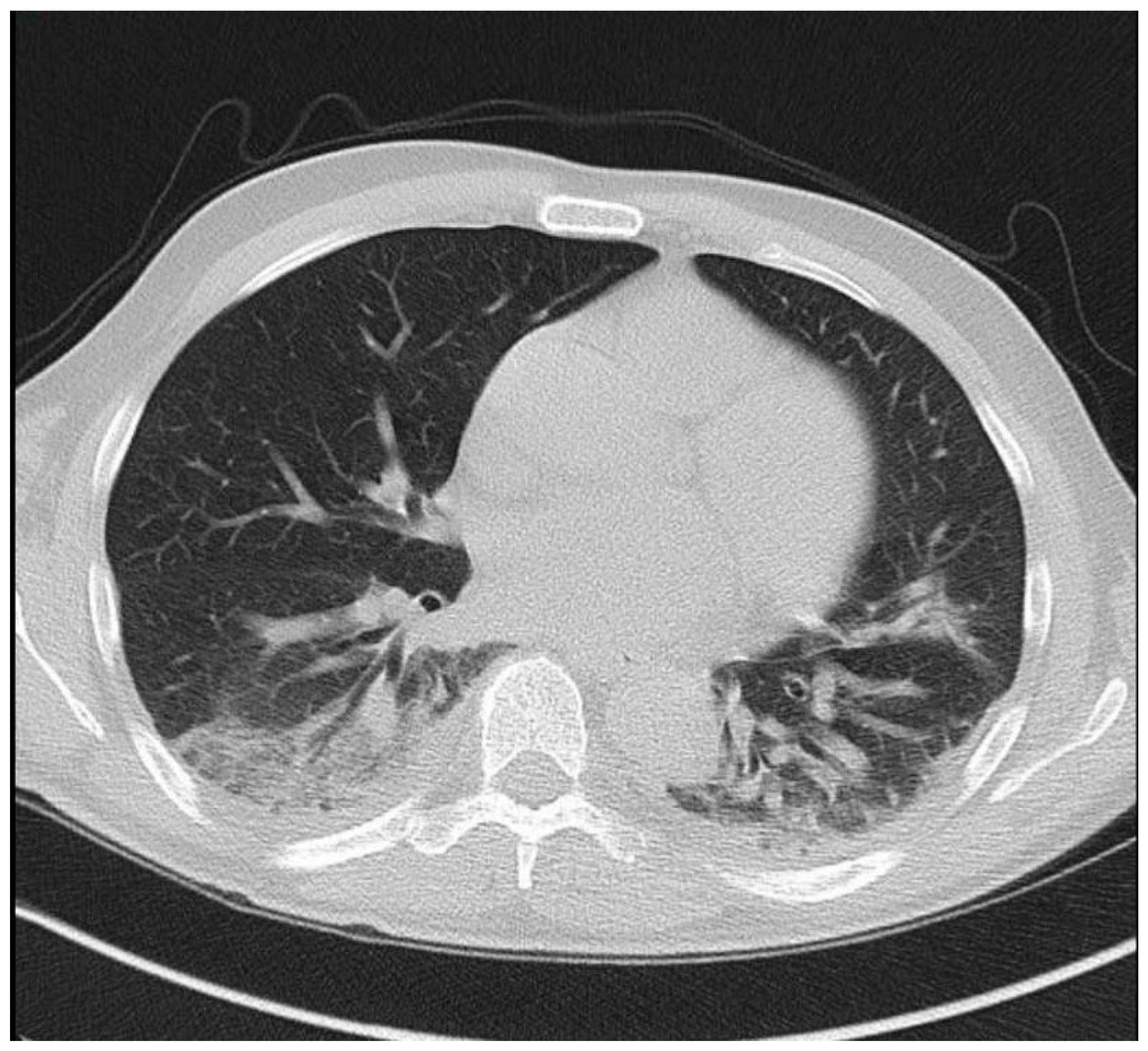 Medicina 56 00355 g001