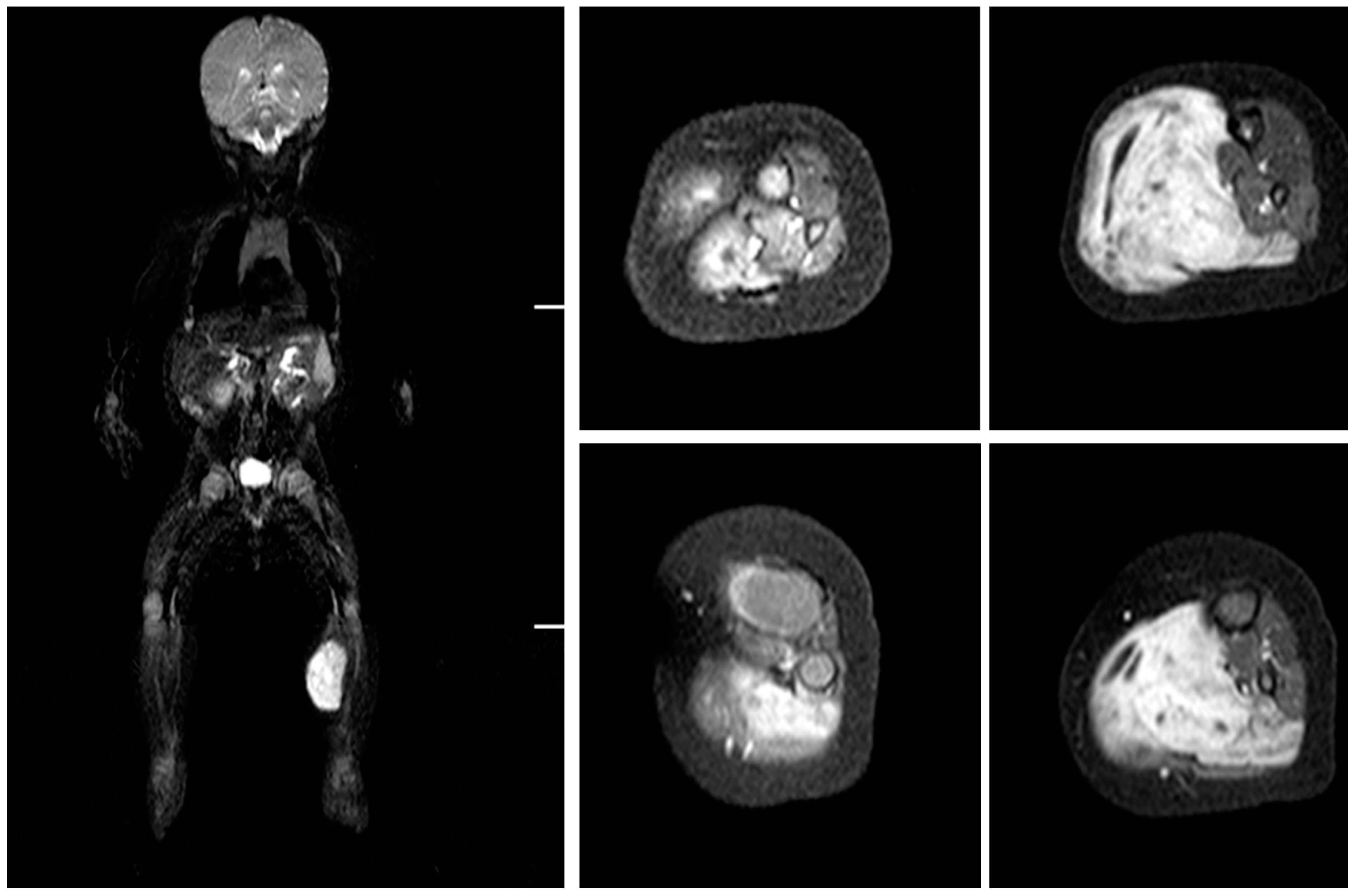 Medicina 56 00362 g002 550