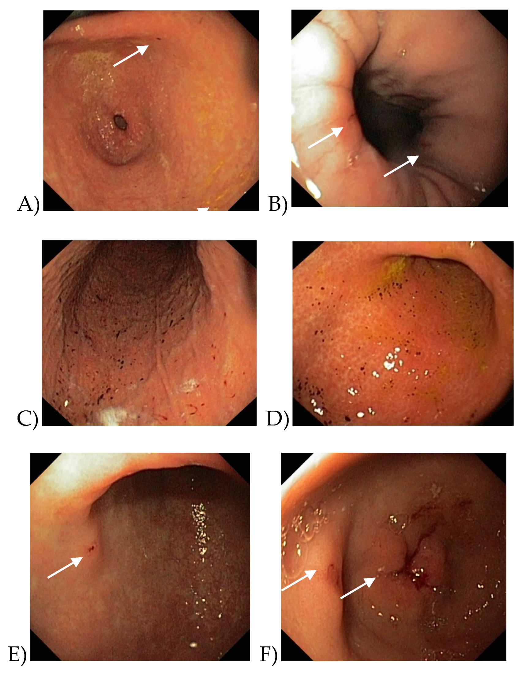 Medicina 56 00363 g004