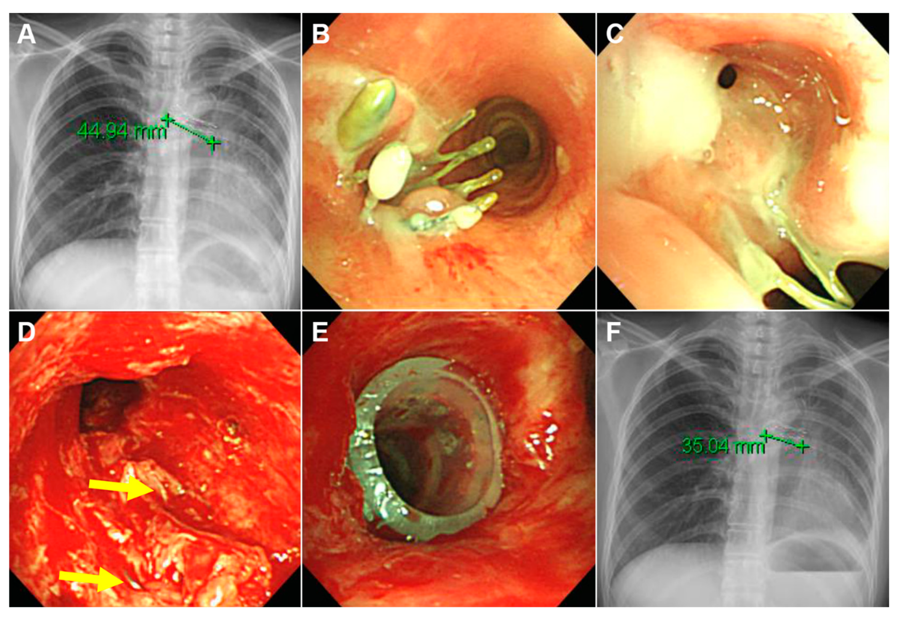 Medicina 56 00367 g002