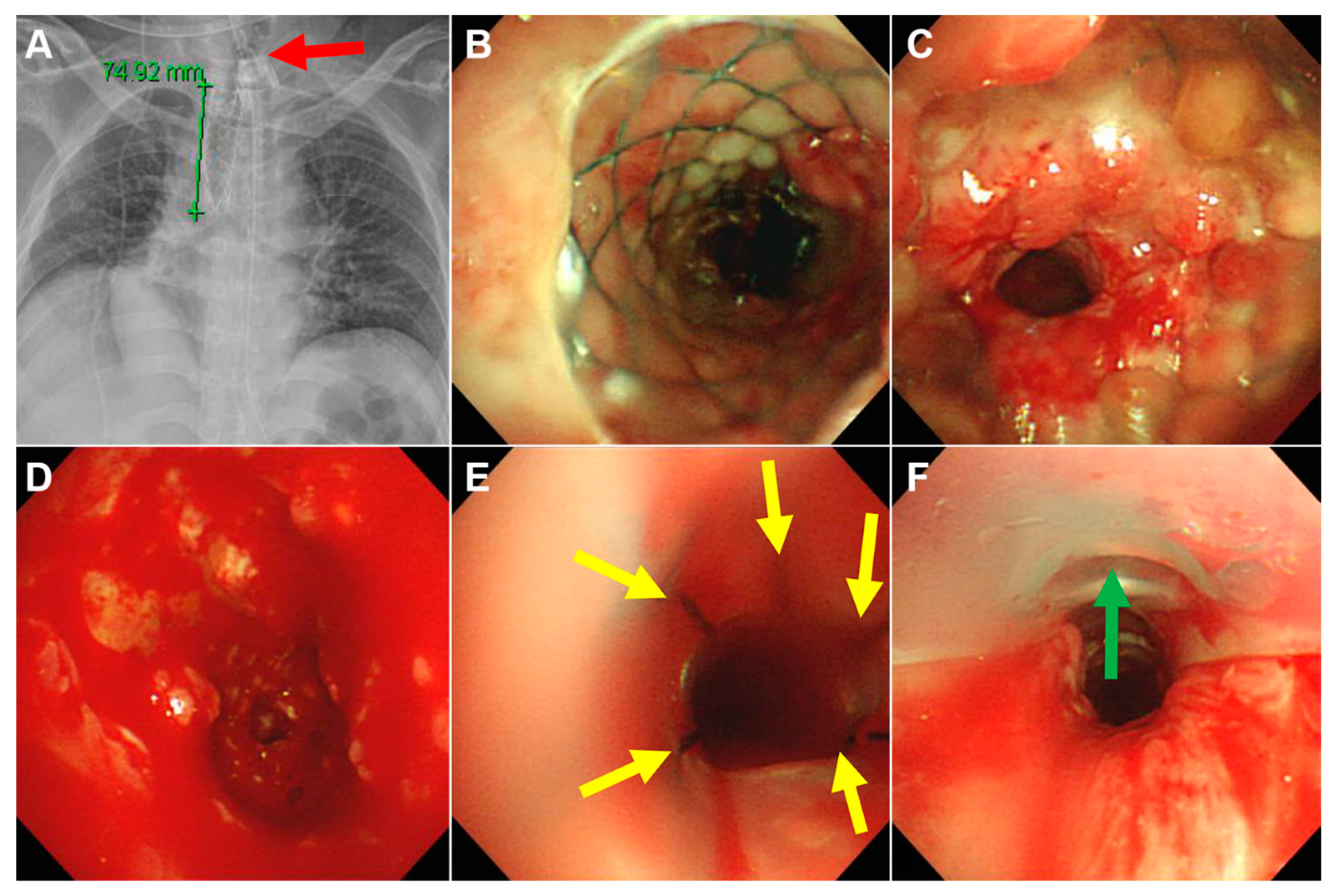 Medicina 56 00367 g003