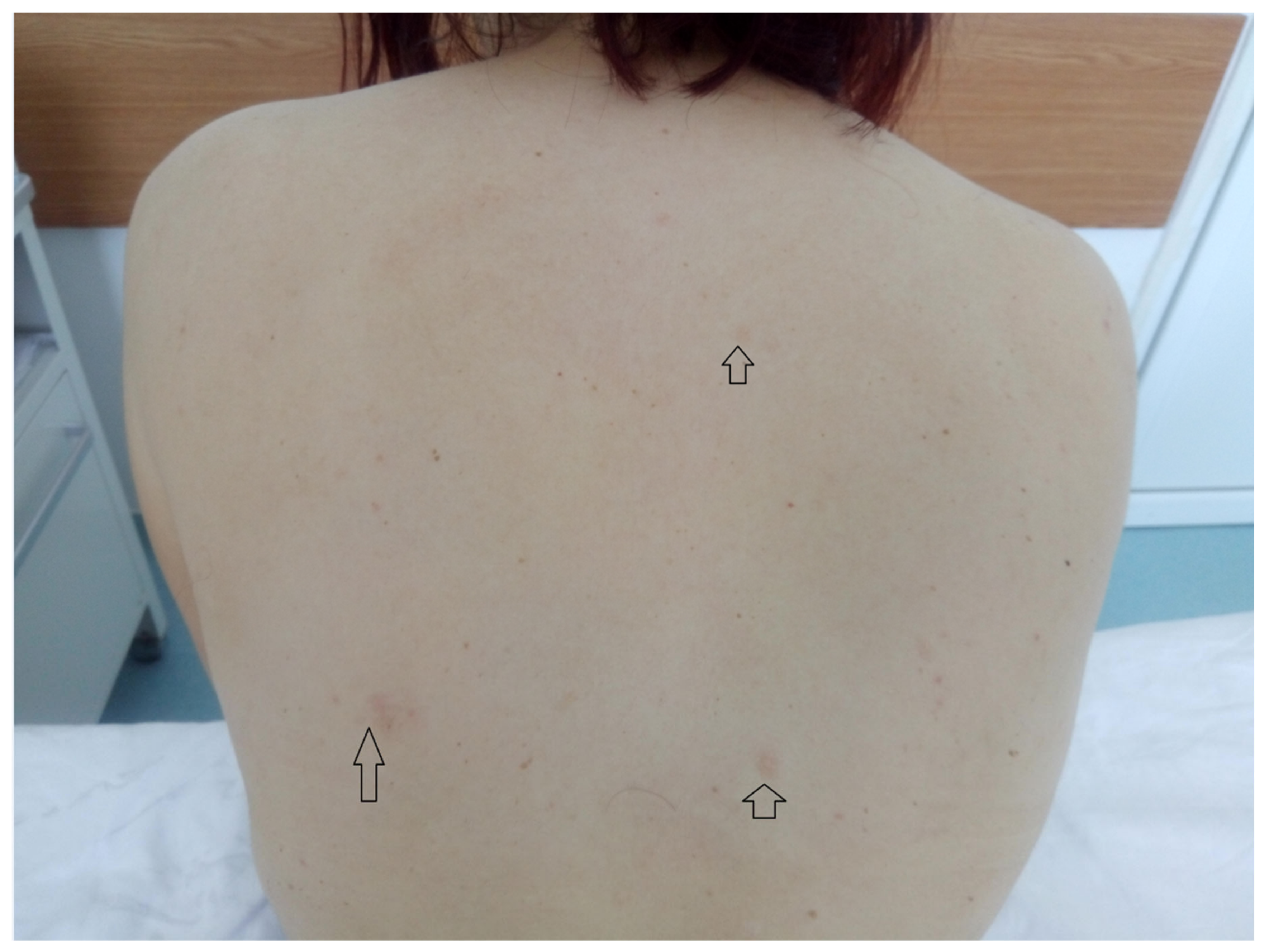 Medicina 56 00369 g004