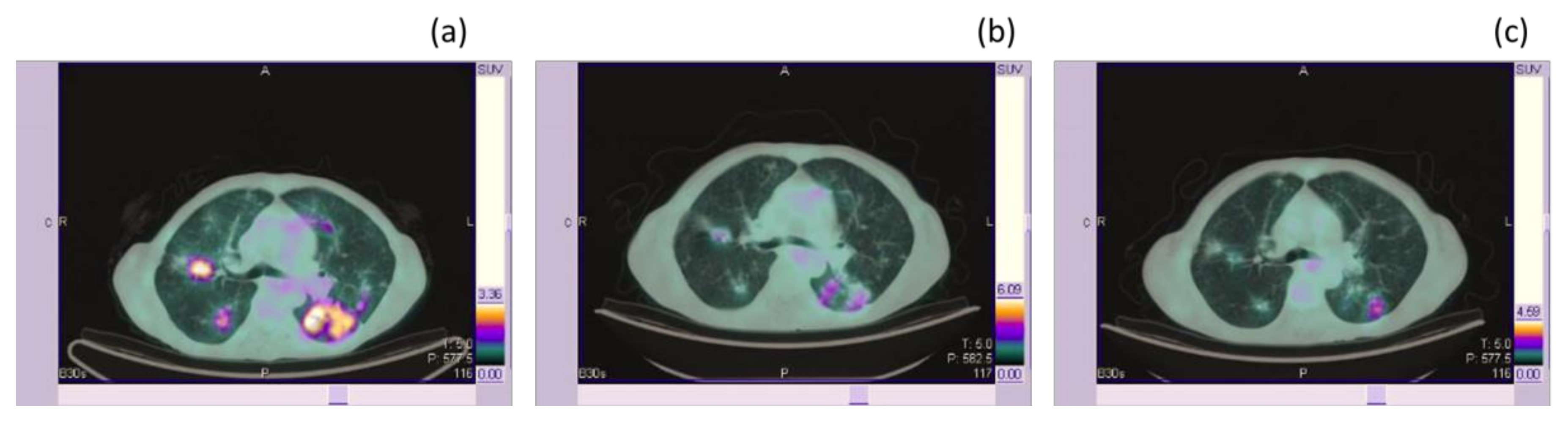 Medicina 56 00373 g001 Medicina 56 00373 g001