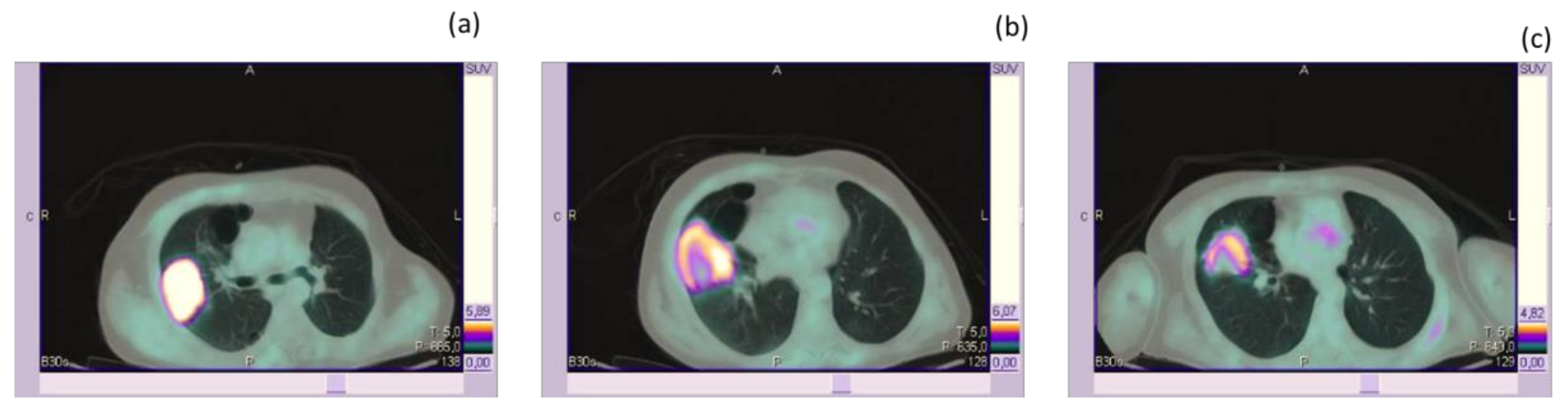 Medicina 56 00373 g002 Medicina 56 00373 g002