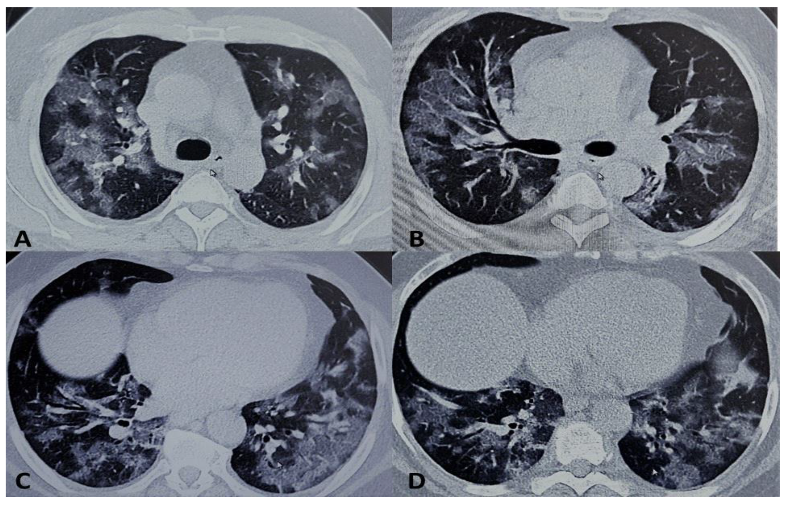 Medicina 56 00377 g001 Medicina 56 00377 g001
