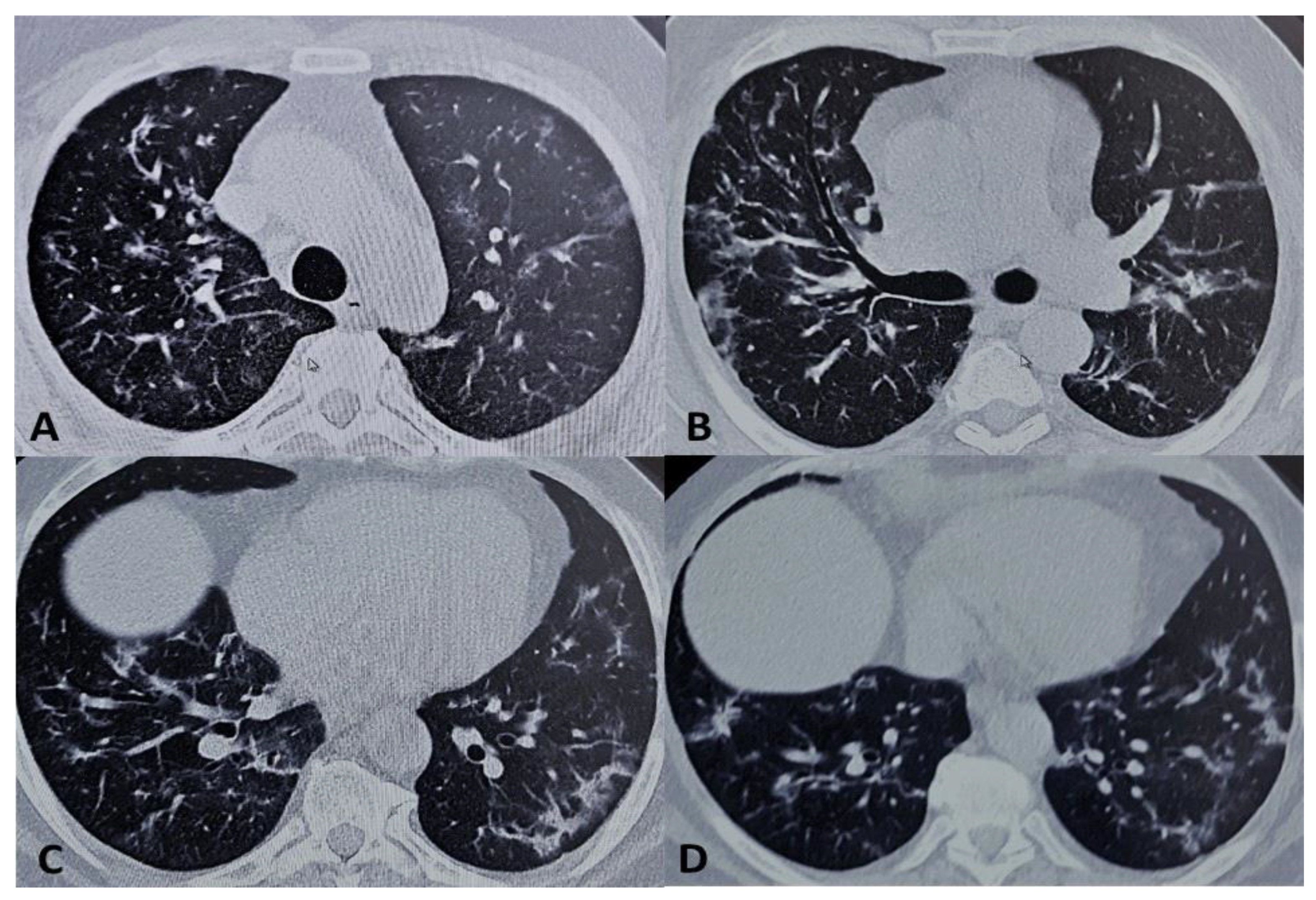 Medicina 56 00377 g002 Medicina 56 00377 g002