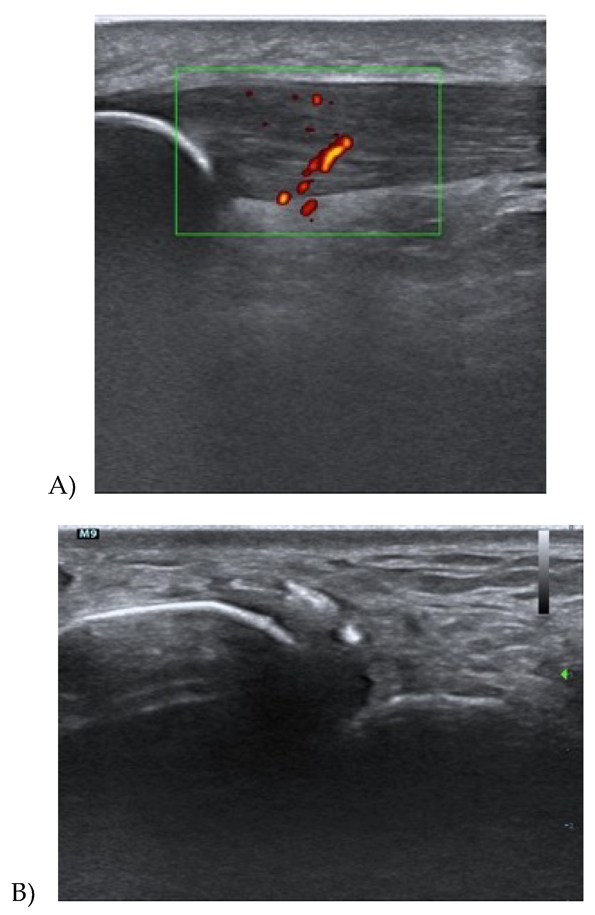 Medicina 56 00378 g002